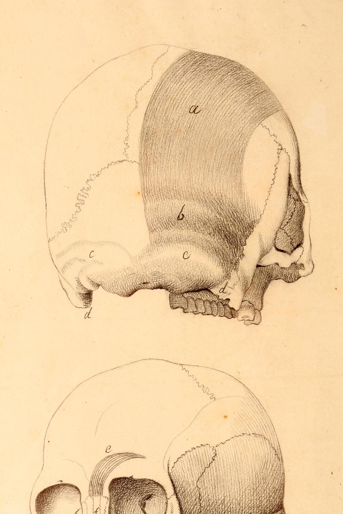 Anatomical drawing of four views of a skull with muscle bands, Italy 1890. In Good Condition For Sale In Milan, IT