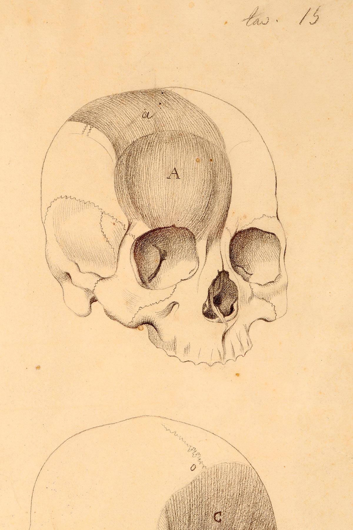 19th Century Anatomical drawing of four views of a skull with muscle bands, Italy 1890. For Sale