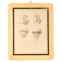 Anatomical drawing of four views of a skull with muscle bands, Italy 1890.