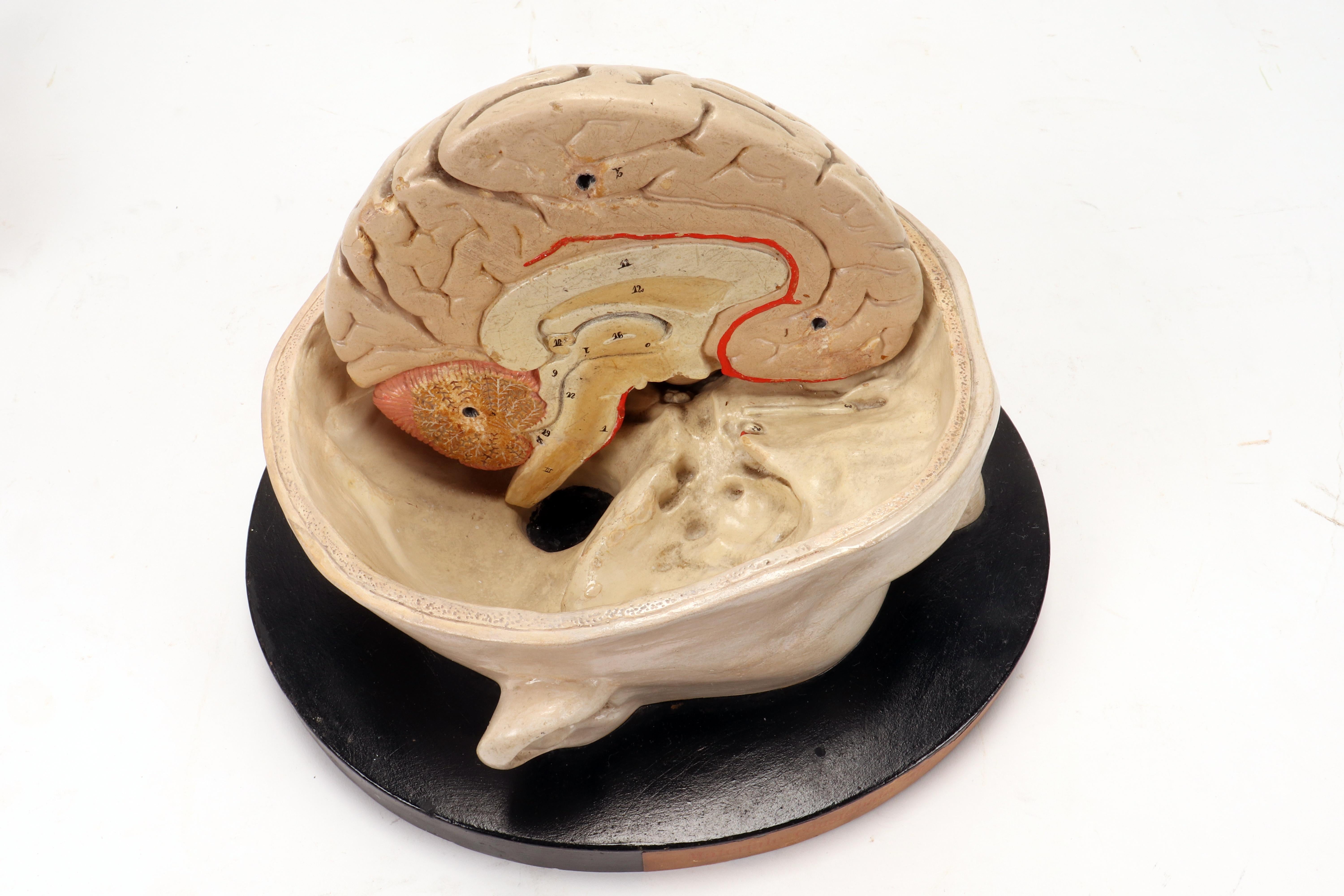 Anatomical model: a brain inserted into a sectioned skullcap, Italy 1920. 4