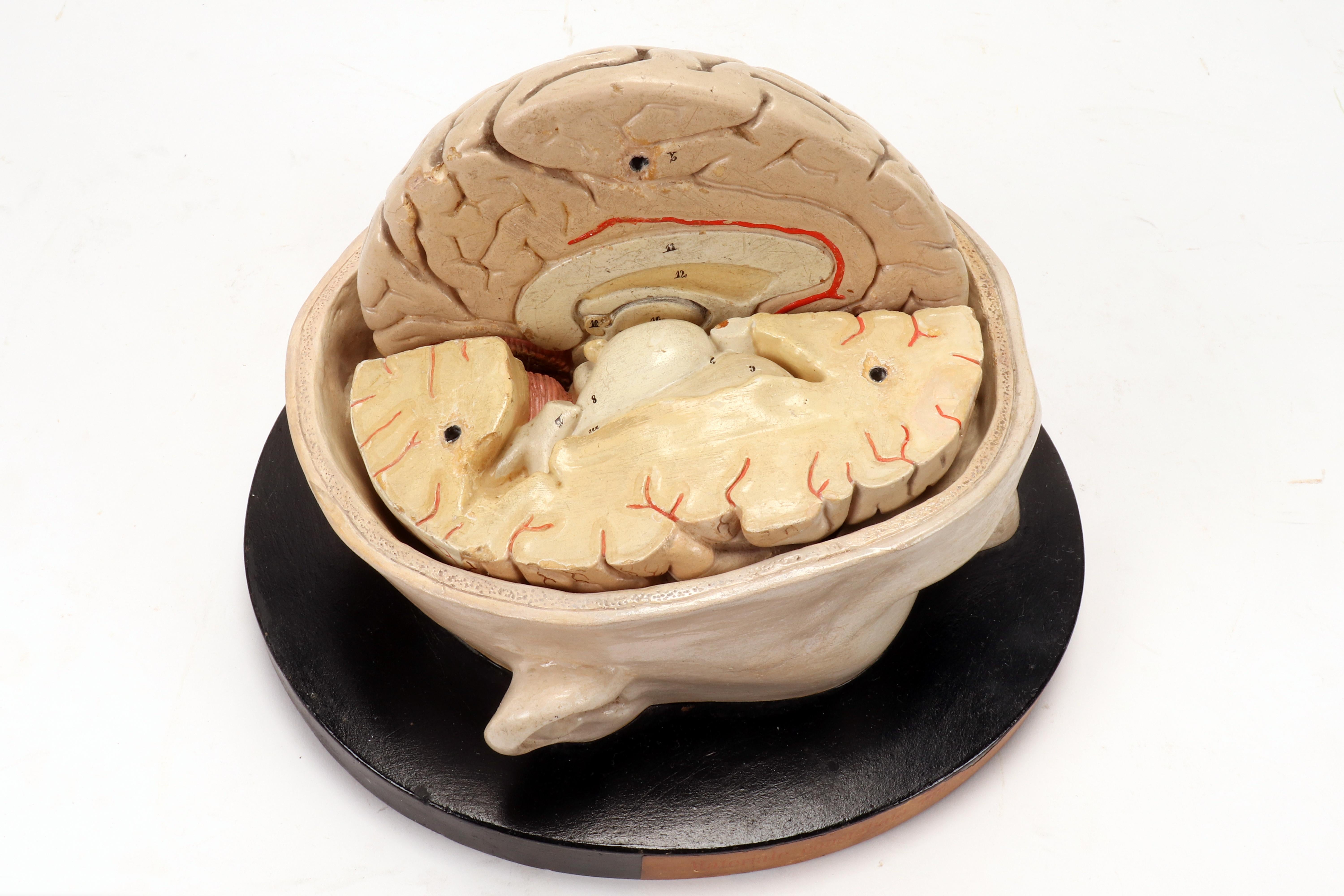 Anatomical model: a brain inserted into a sectioned skullcap, Italy 1920. 5