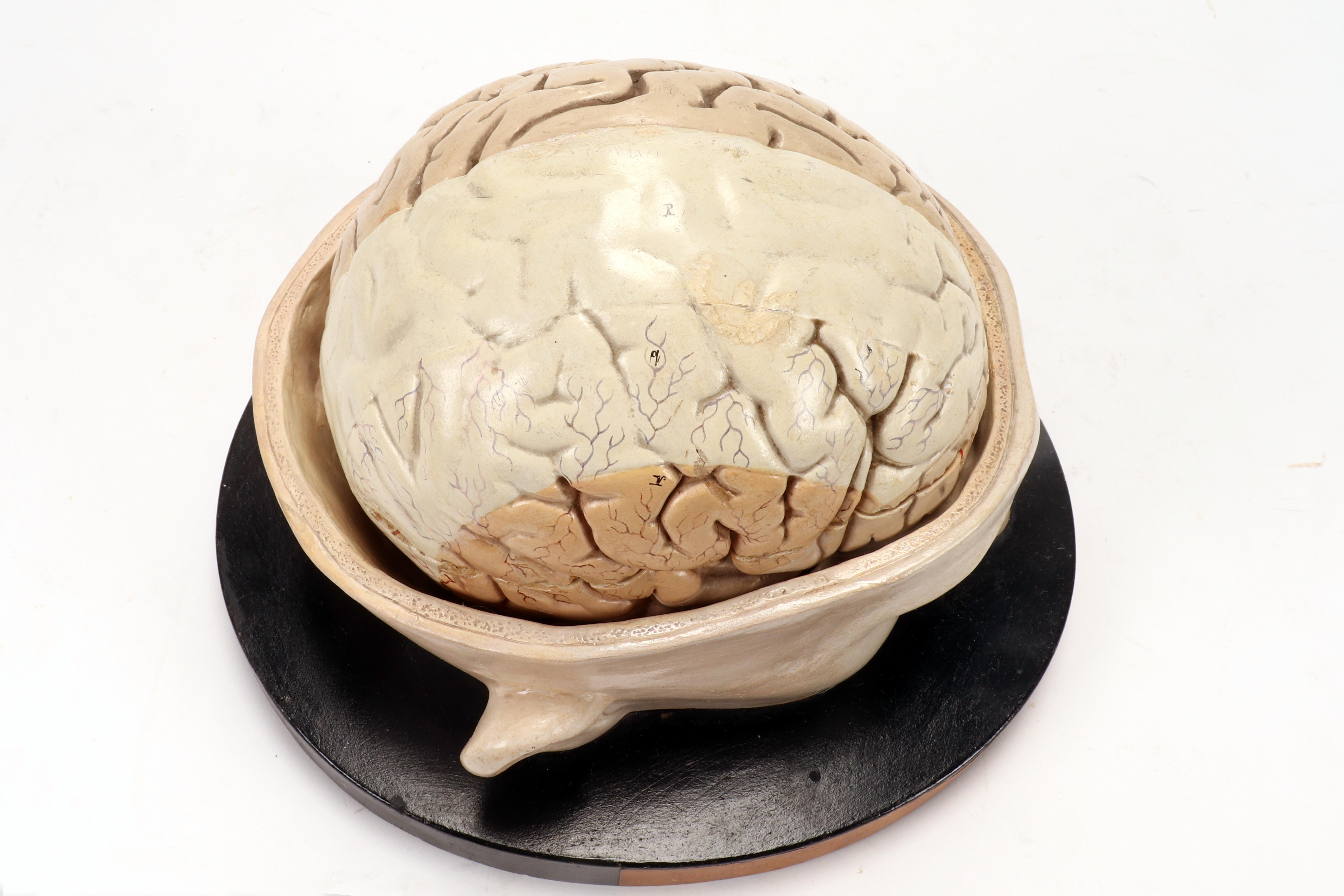 Anatomical model: a brain inserted into a sectioned skullcap, Italy 1920. 6