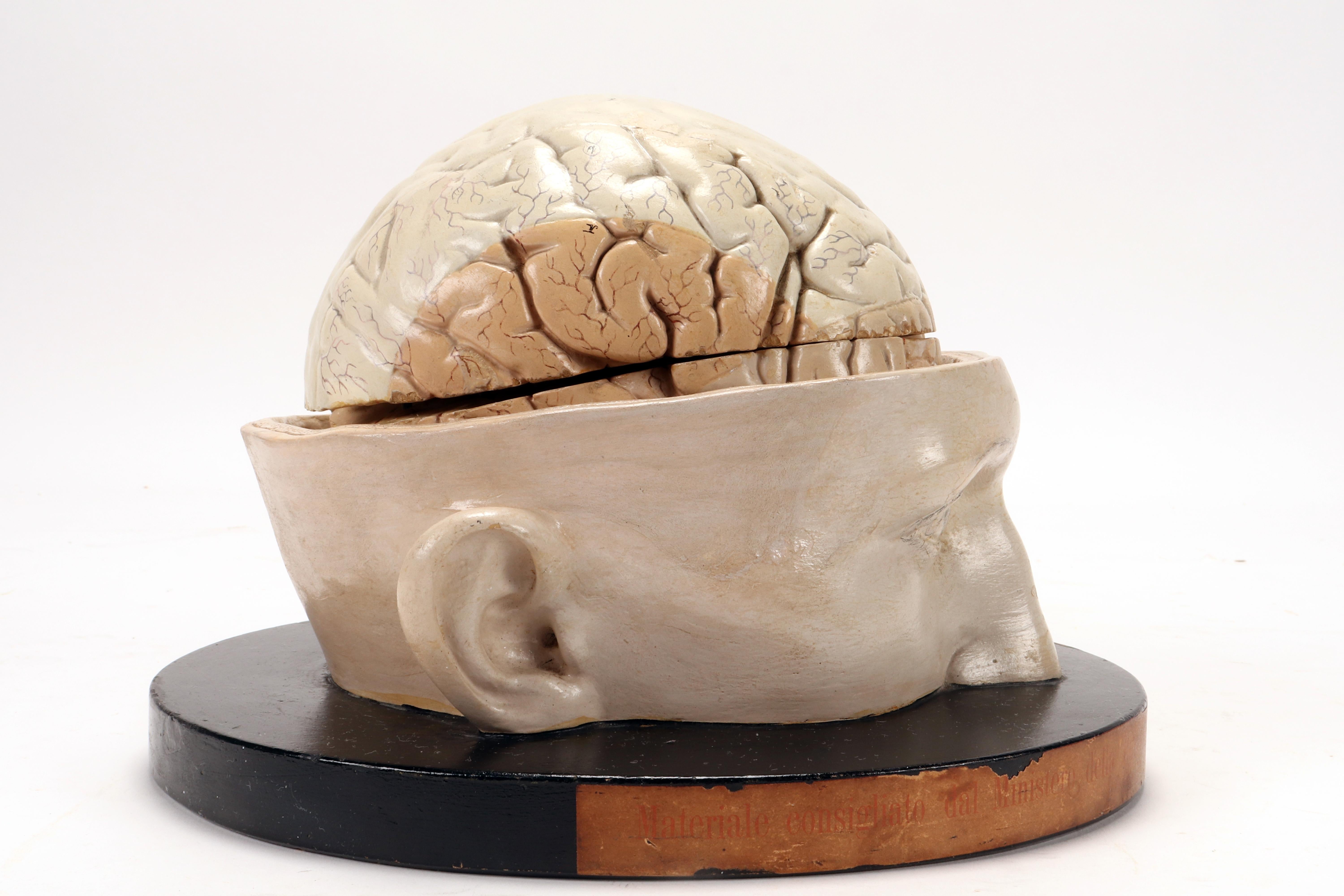 Italian Anatomical model: a brain inserted into a sectioned skullcap, Italy 1920.