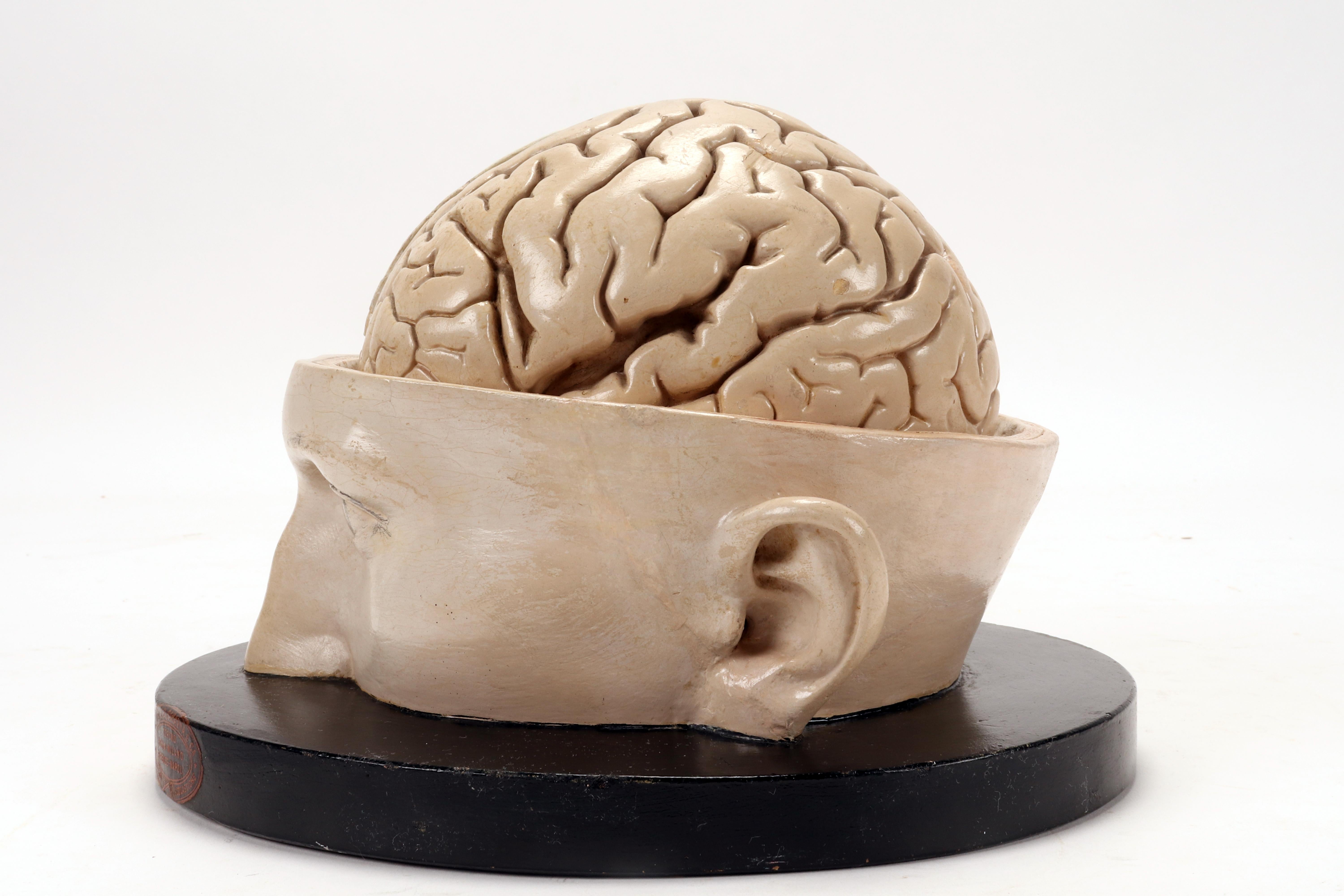 Anatomical model: a brain inserted into a sectioned skullcap, Italy 1920. In Good Condition In Milan, IT