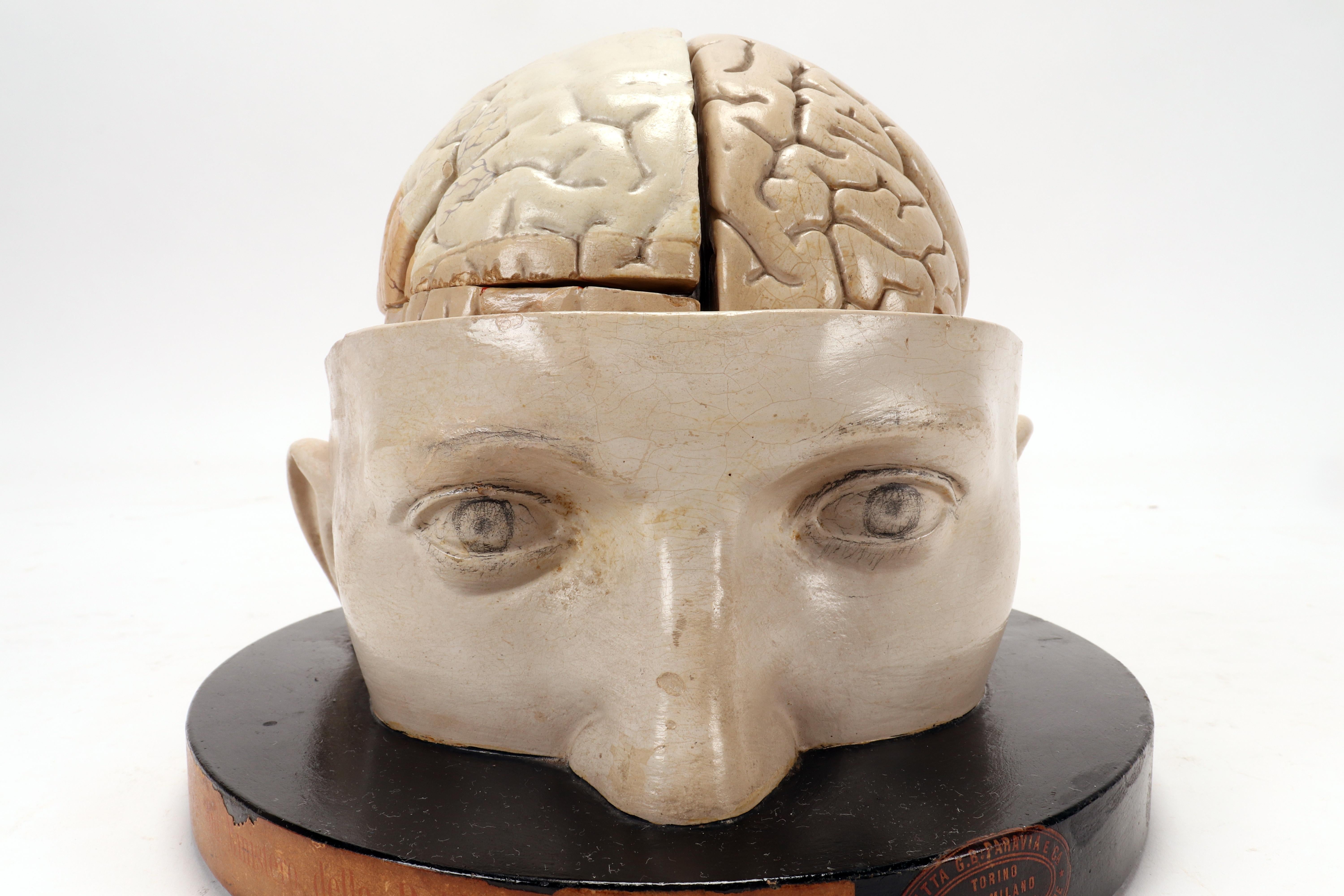 Plaster Anatomical model: a brain inserted into a sectioned skullcap, Italy 1920.
