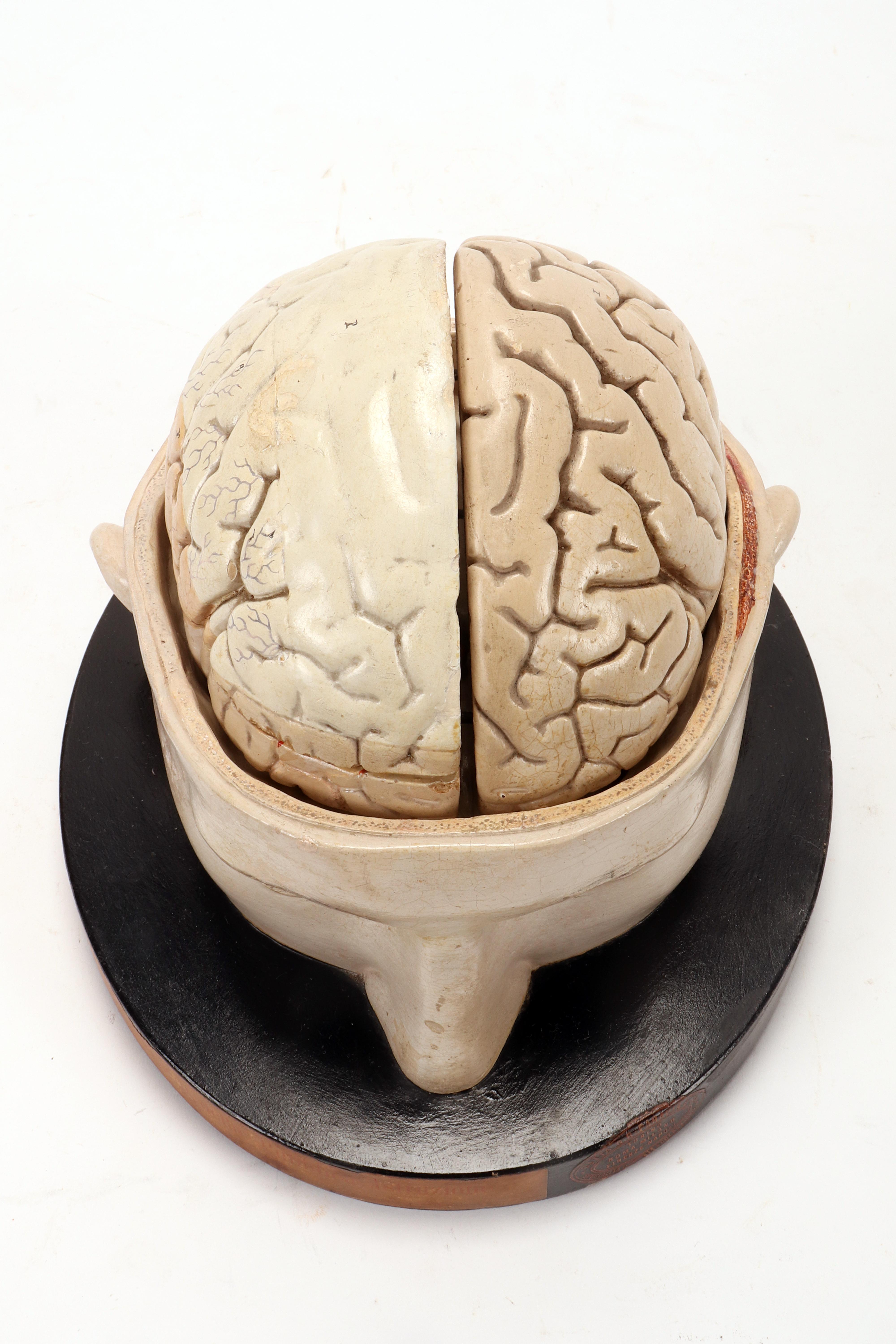 Anatomical model: a brain inserted into a sectioned skullcap, Italy 1920. 1