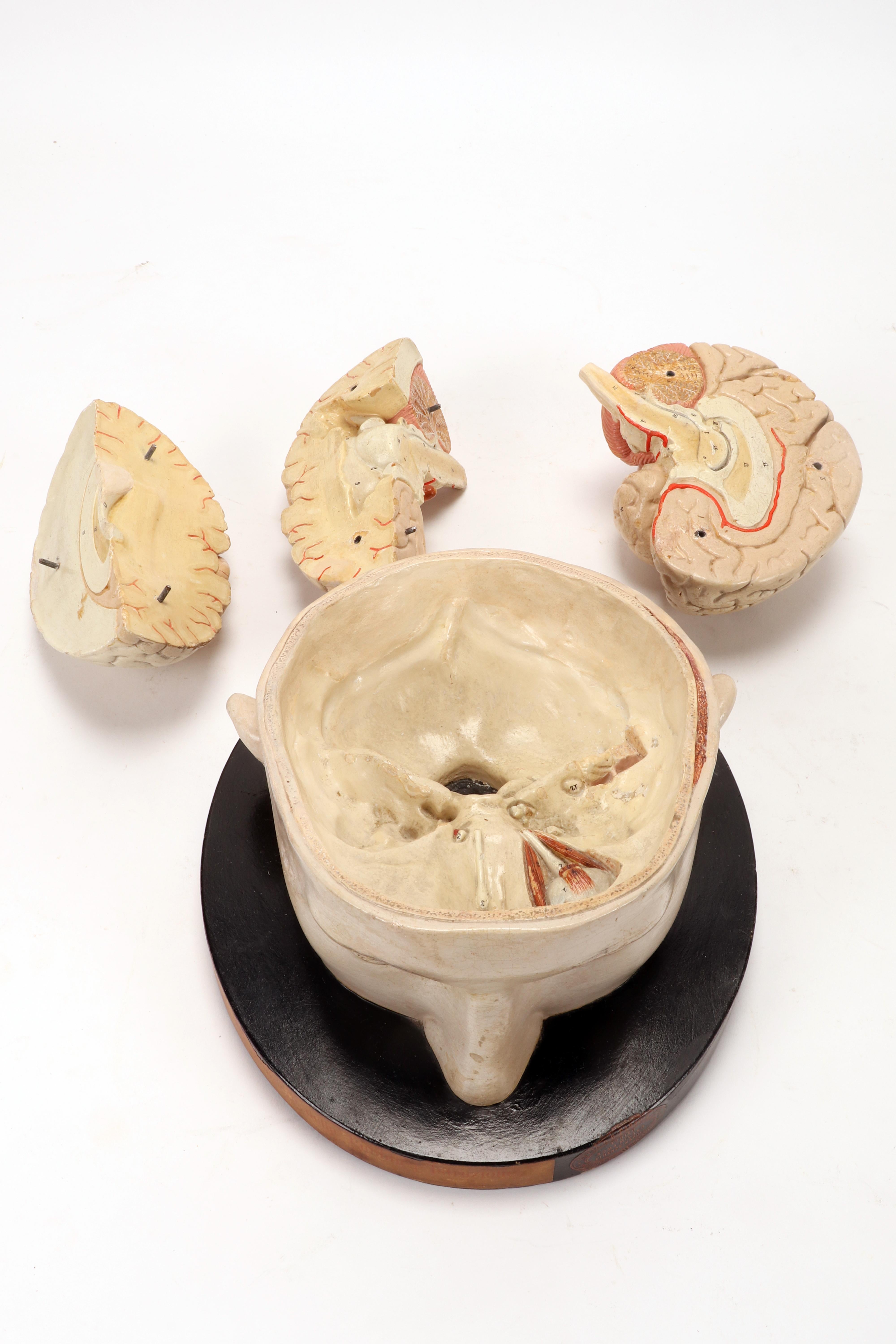 Anatomical model: a brain inserted into a sectioned skullcap, Italy 1920. 2