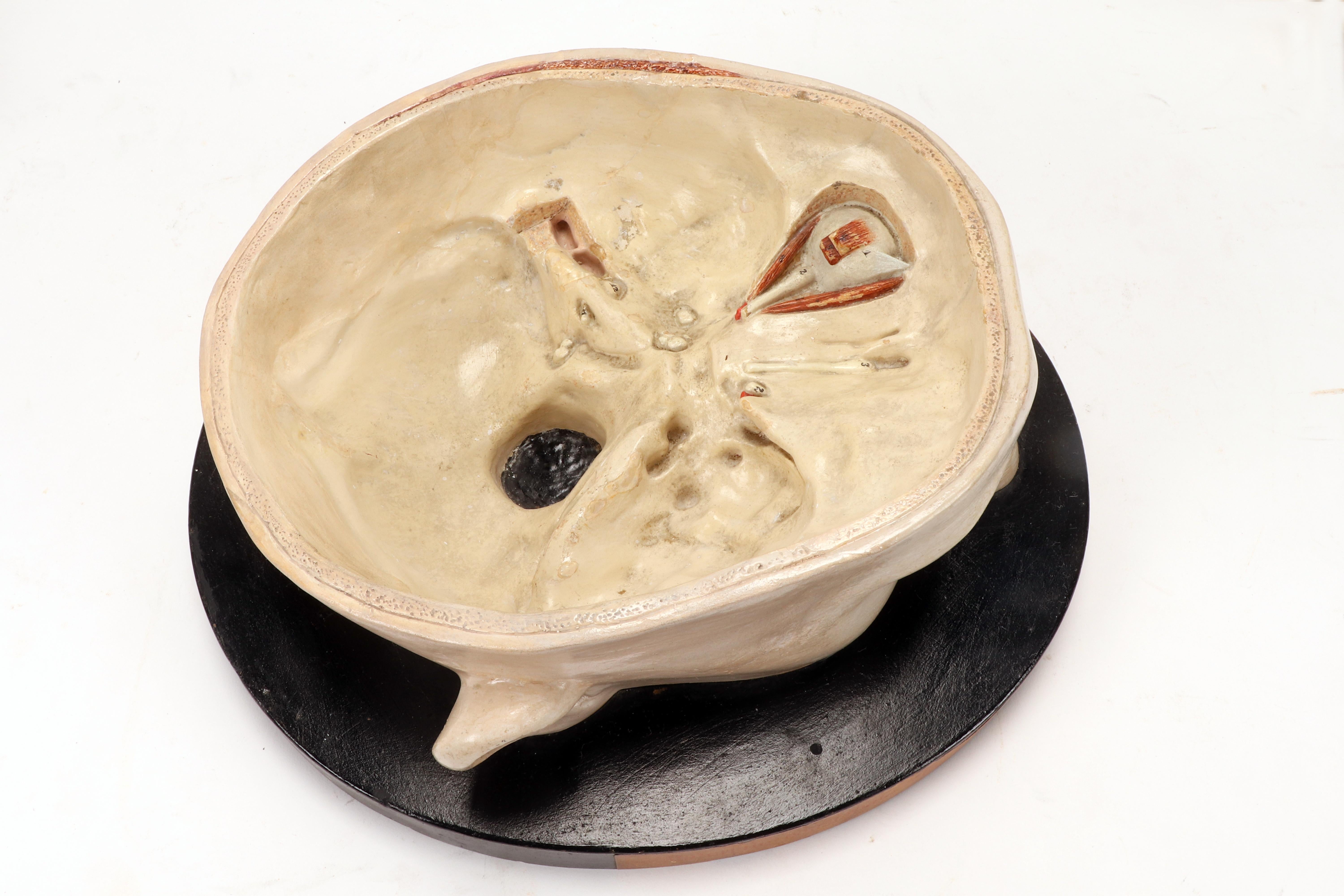 Anatomical model: a brain inserted into a sectioned skullcap, Italy 1920. 3