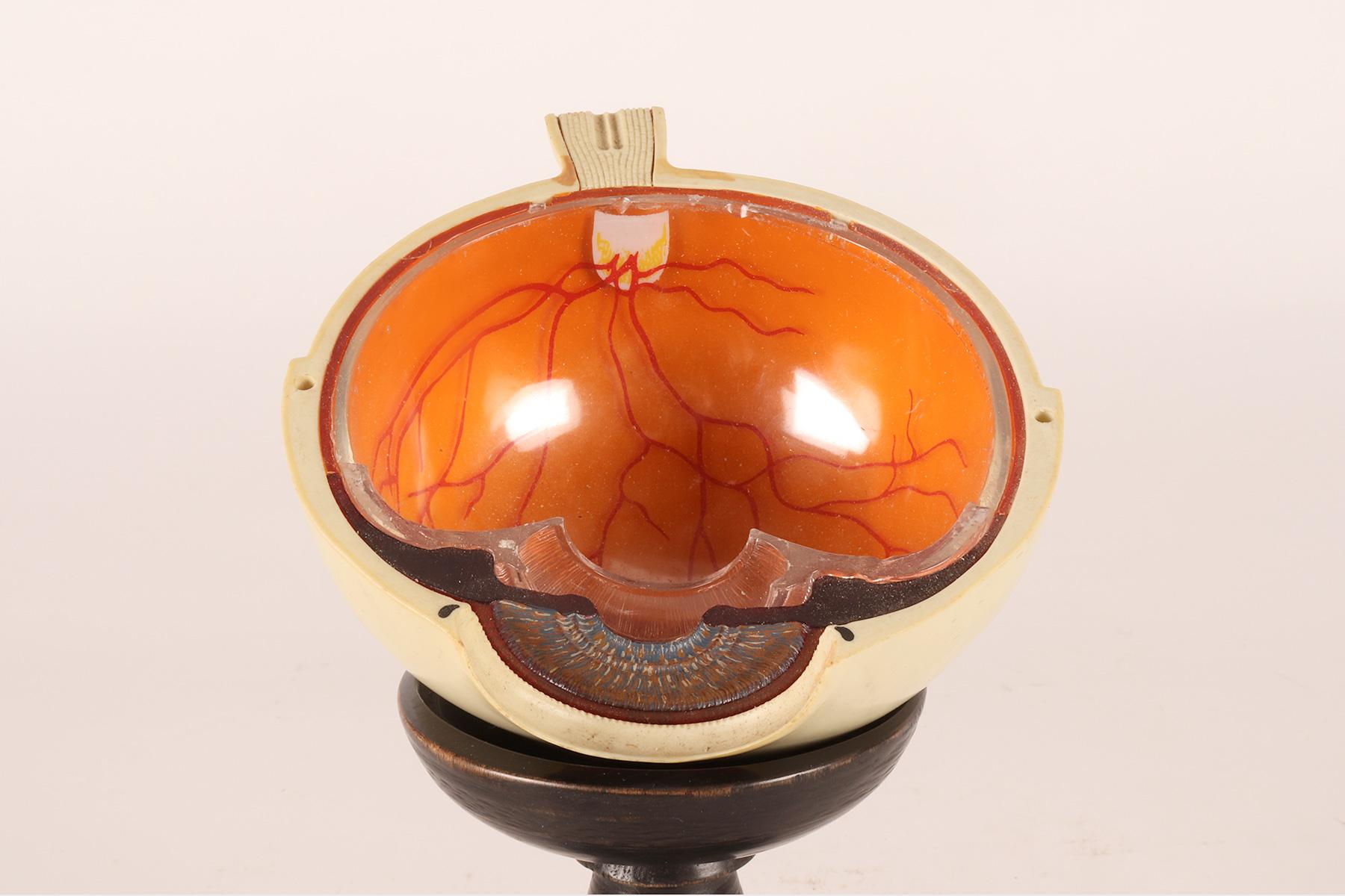 Anatomical model: a decomposable eyeball, SOMSO, Germany circa 1950.  For Sale 4