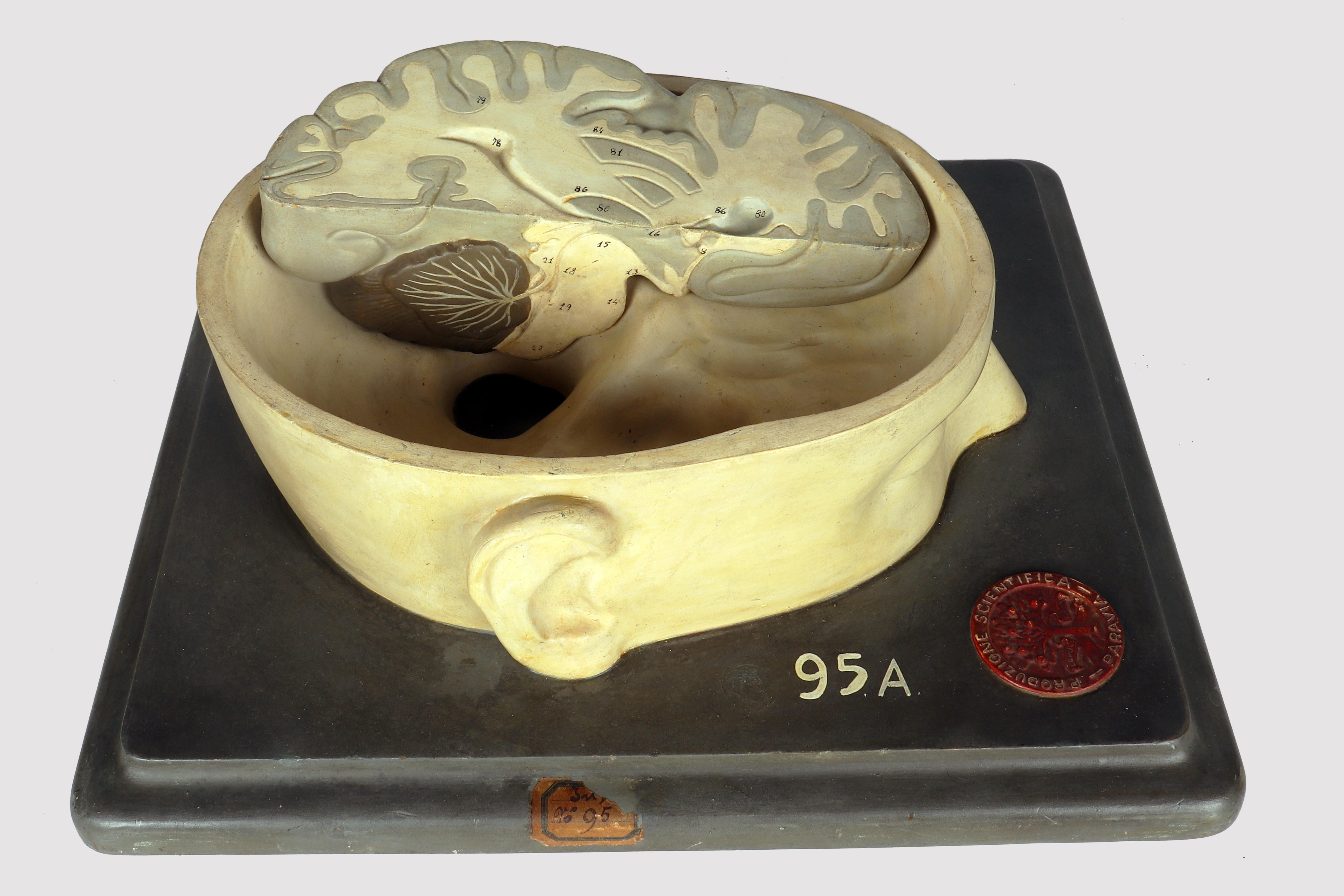 Modèle anatomique : un cerveau humain inséré dans une capuchon de crâne sectionnée, Italie 1920 en vente 4