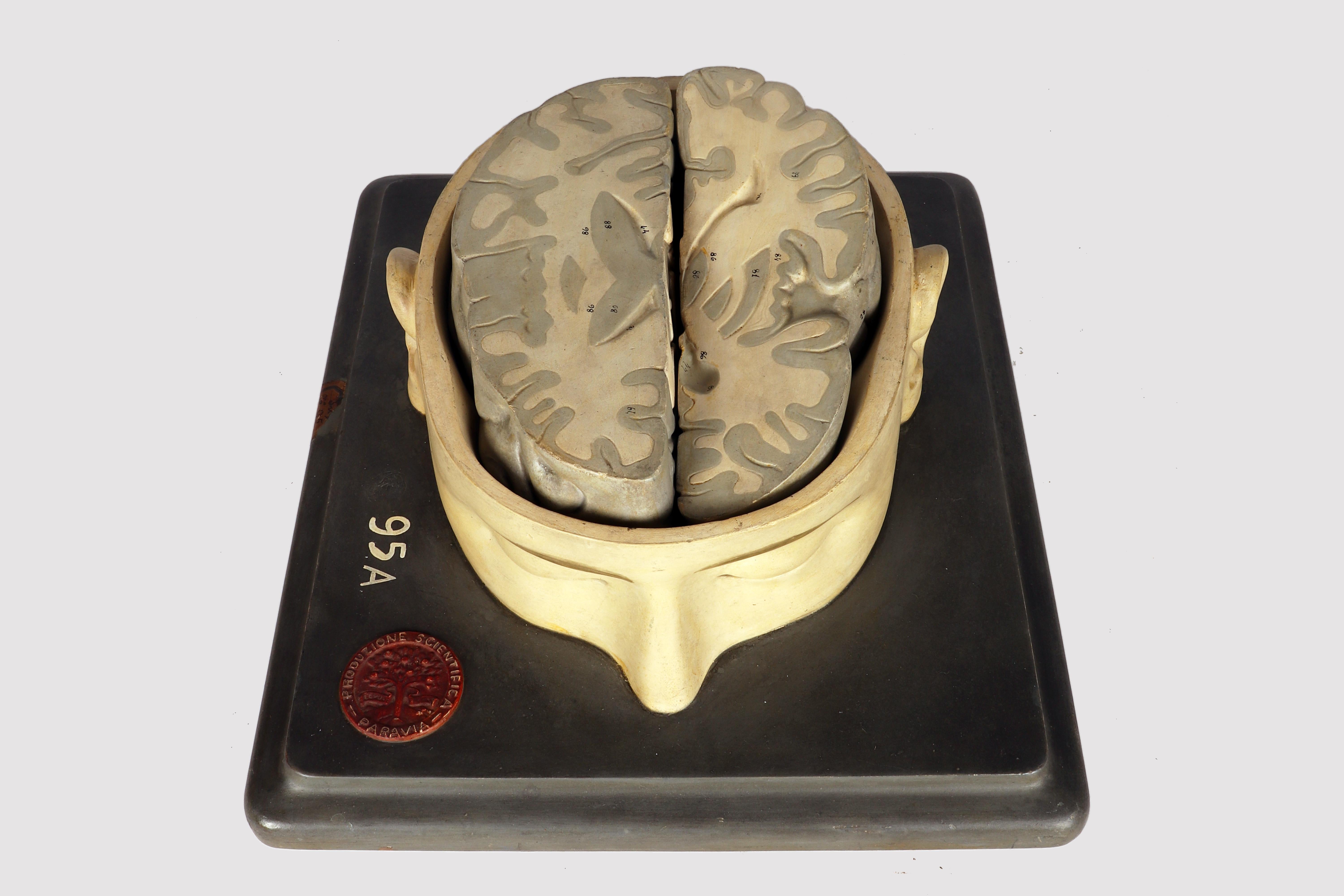 Modèle anatomique : un cerveau humain inséré dans une capuchon de crâne sectionnée, Italie 1920 en vente 5