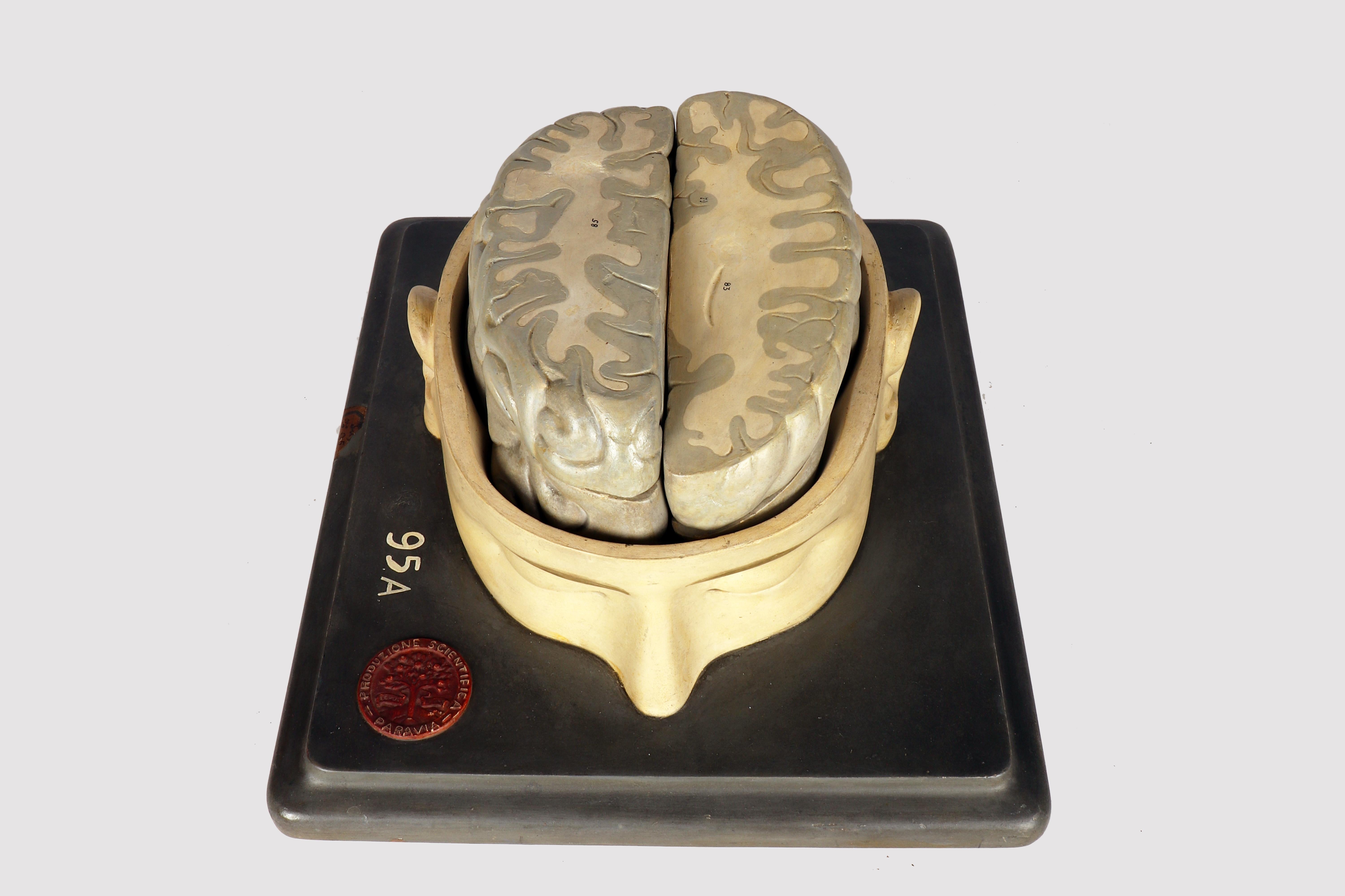 Modèle anatomique : un cerveau humain inséré dans une capuchon de crâne sectionnée, Italie 1920 en vente 6