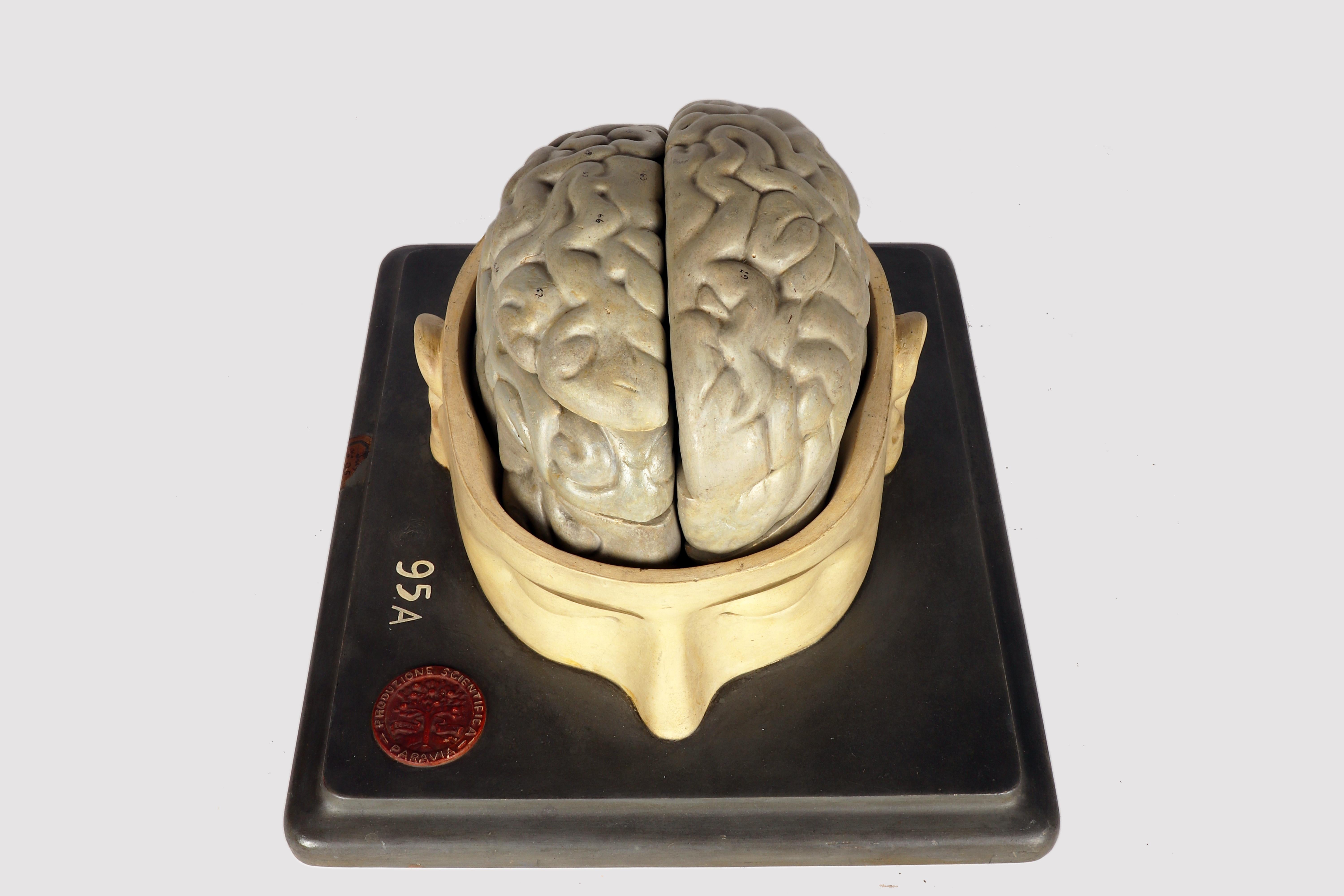 Modèle anatomique : un cerveau humain inséré dans une capuchon de crâne sectionnée, Italie 1920 en vente 7