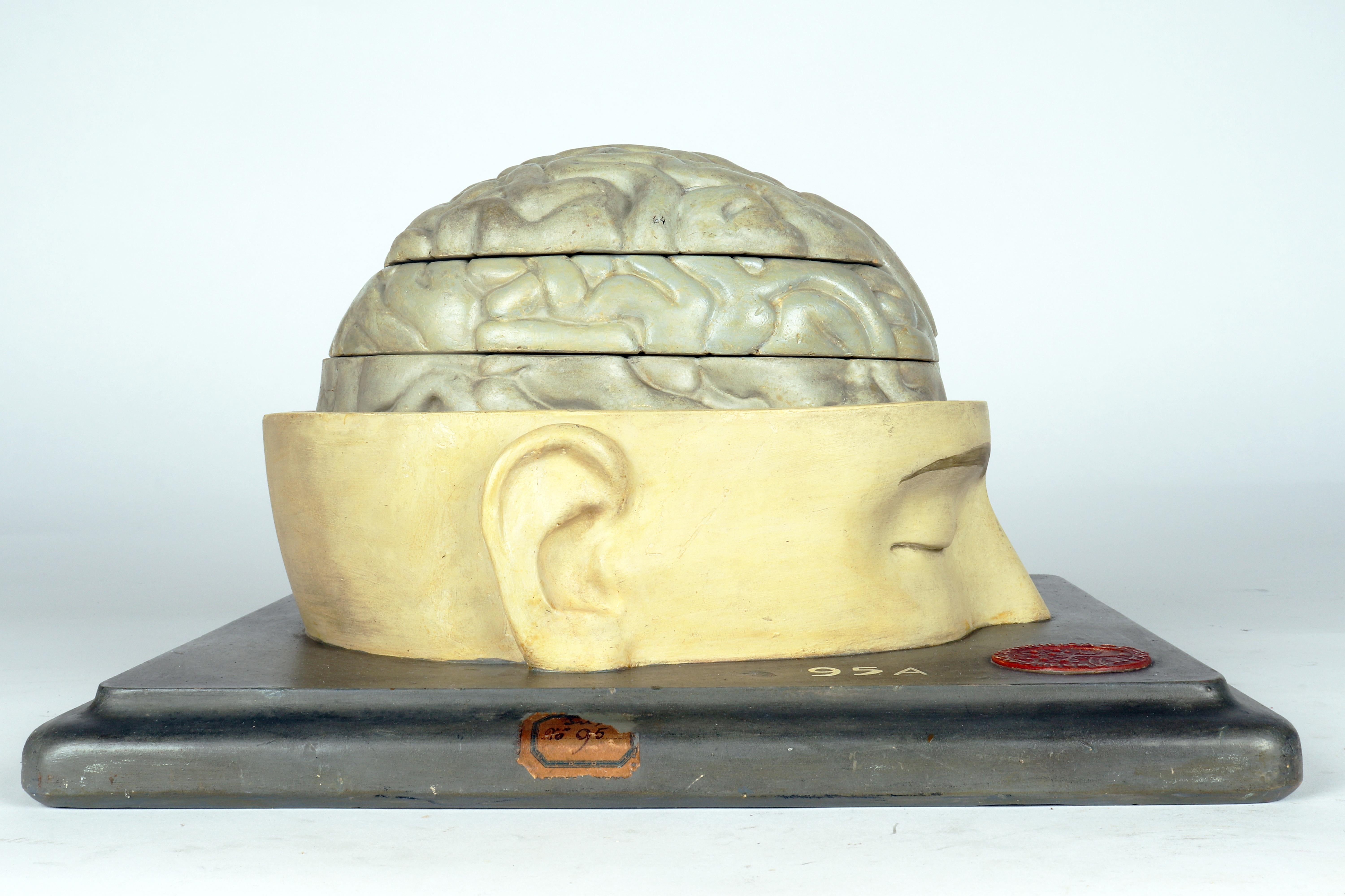 italien Modèle anatomique : un cerveau humain inséré dans une capuchon de crâne sectionnée, Italie 1920 en vente