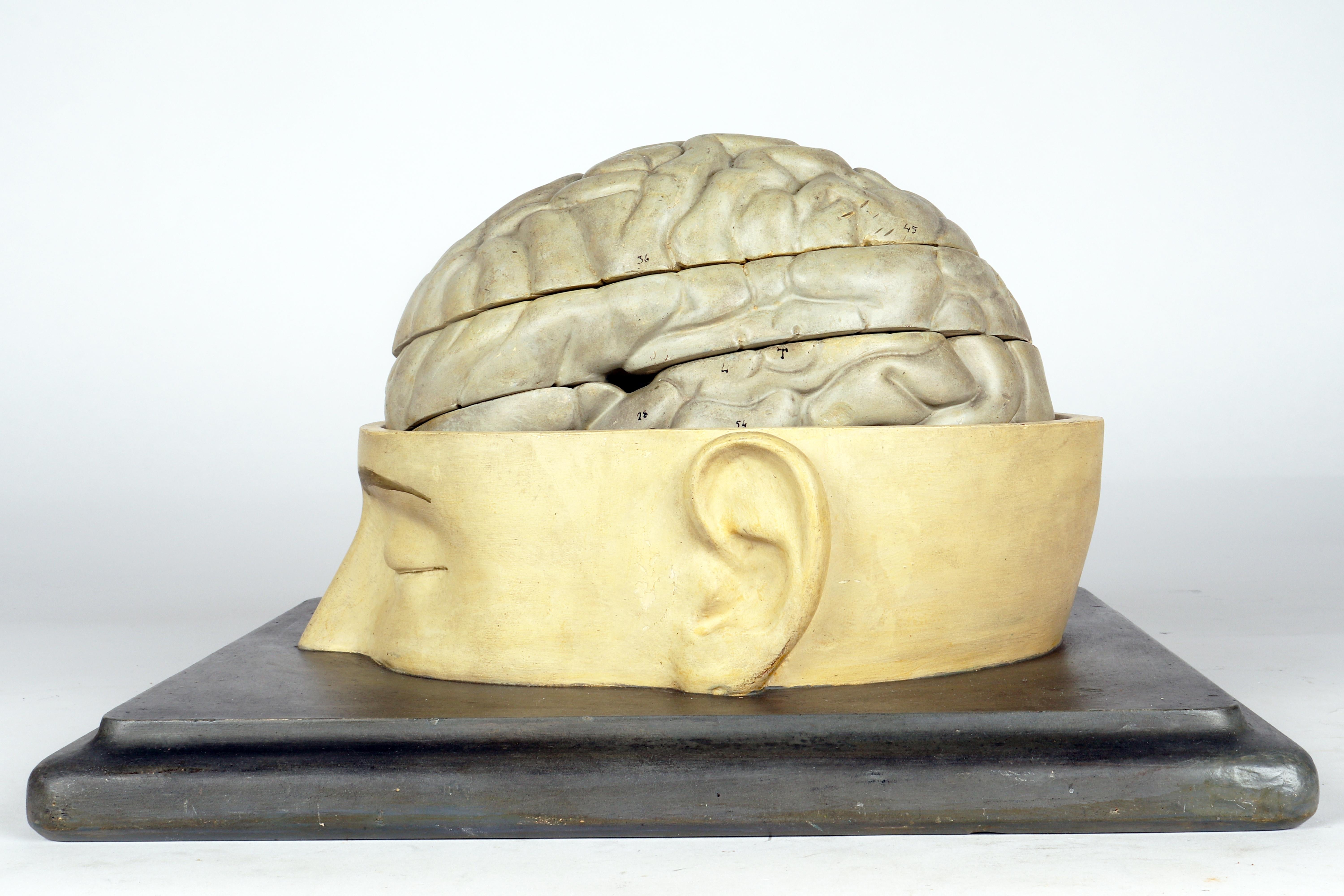 Modèle anatomique : un cerveau humain inséré dans une capuchon de crâne sectionnée, Italie 1920 Bon état - En vente à Milan, IT