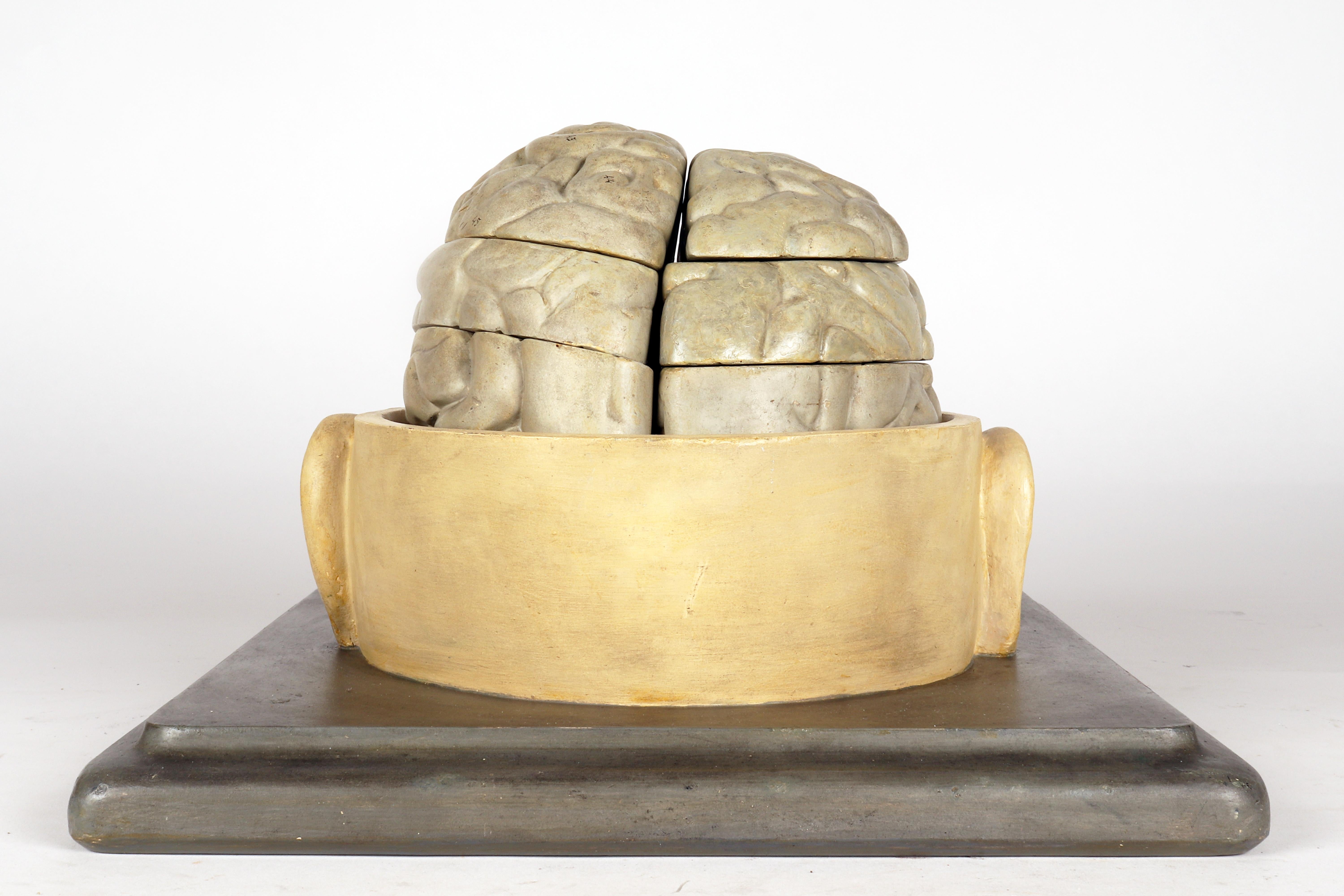 20ième siècle Modèle anatomique : un cerveau humain inséré dans une capuchon de crâne sectionnée, Italie 1920 en vente