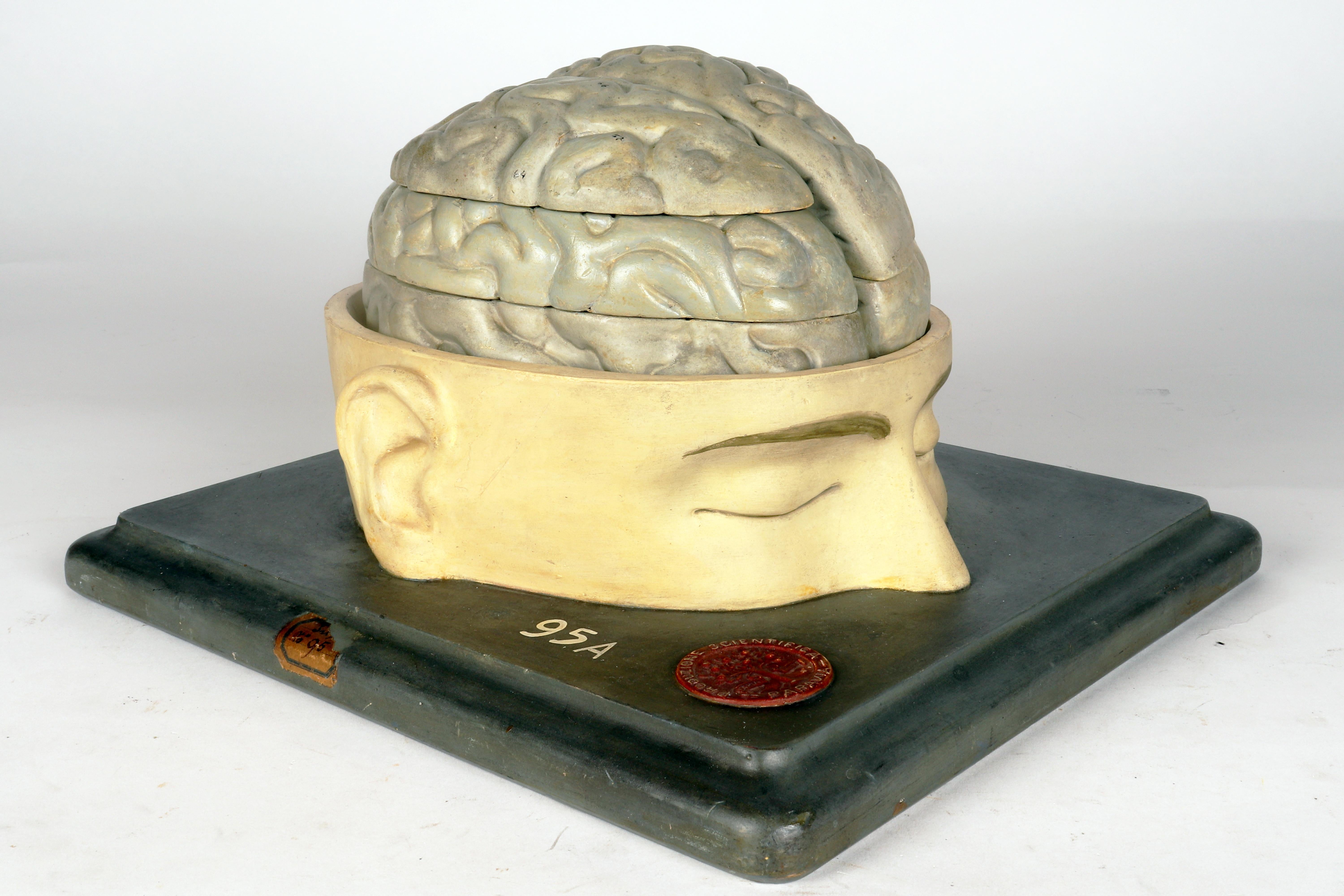 Plâtre Modèle anatomique : un cerveau humain inséré dans une capuchon de crâne sectionnée, Italie 1920 en vente