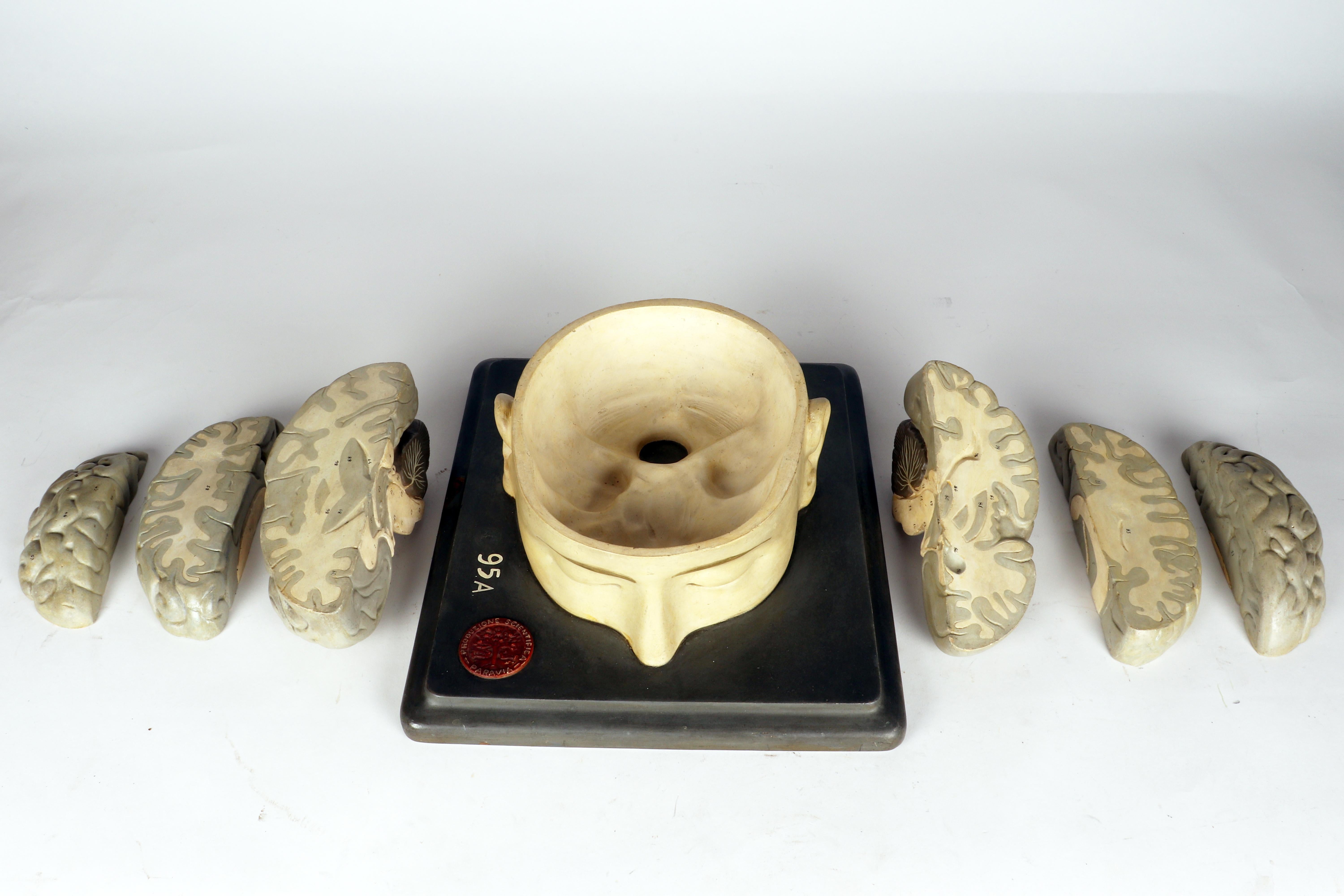 Modèle anatomique : un cerveau humain inséré dans une capuchon de crâne sectionnée, Italie 1920 en vente 1