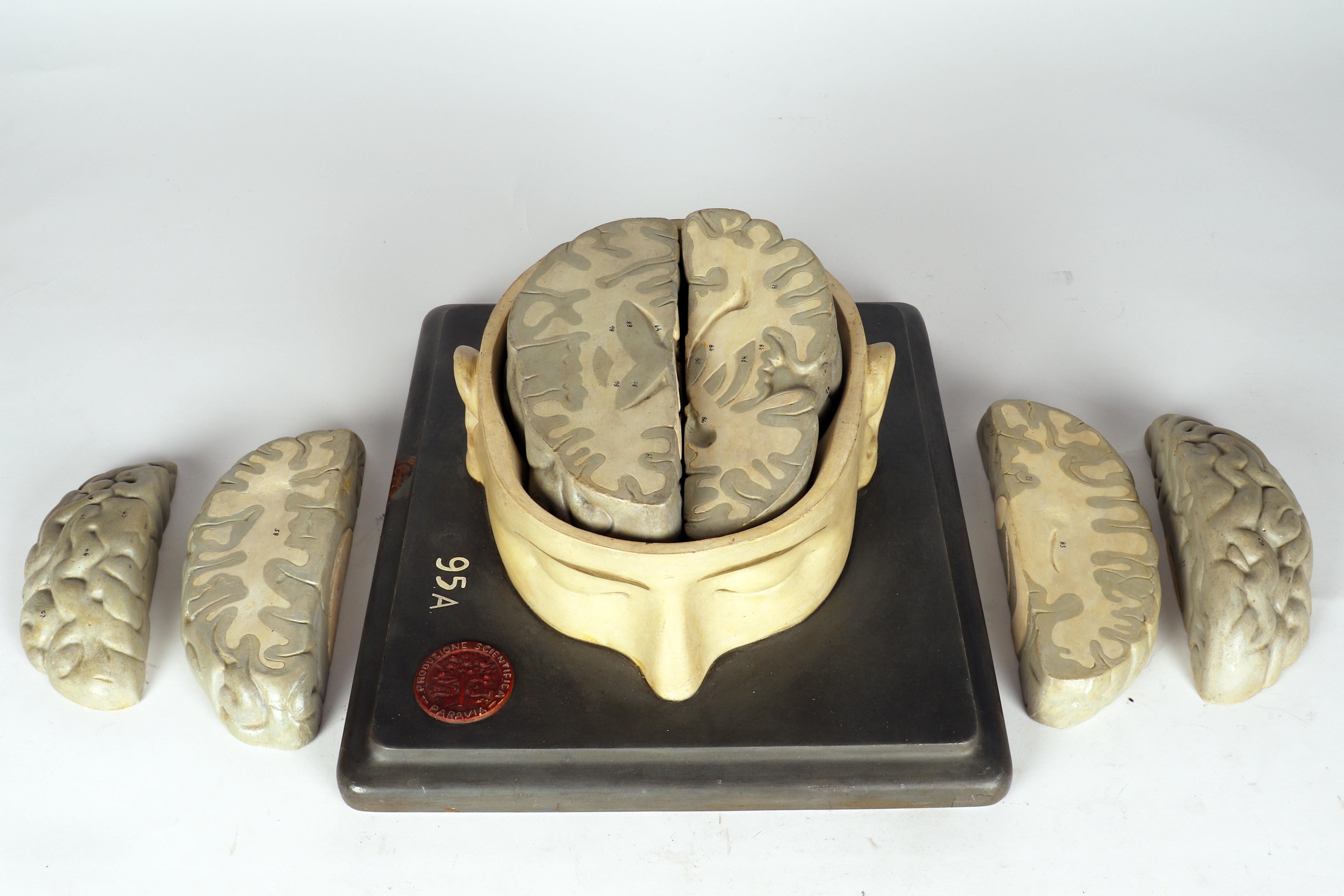 Modèle anatomique : un cerveau humain inséré dans une capuchon de crâne sectionnée, Italie 1920 en vente 2