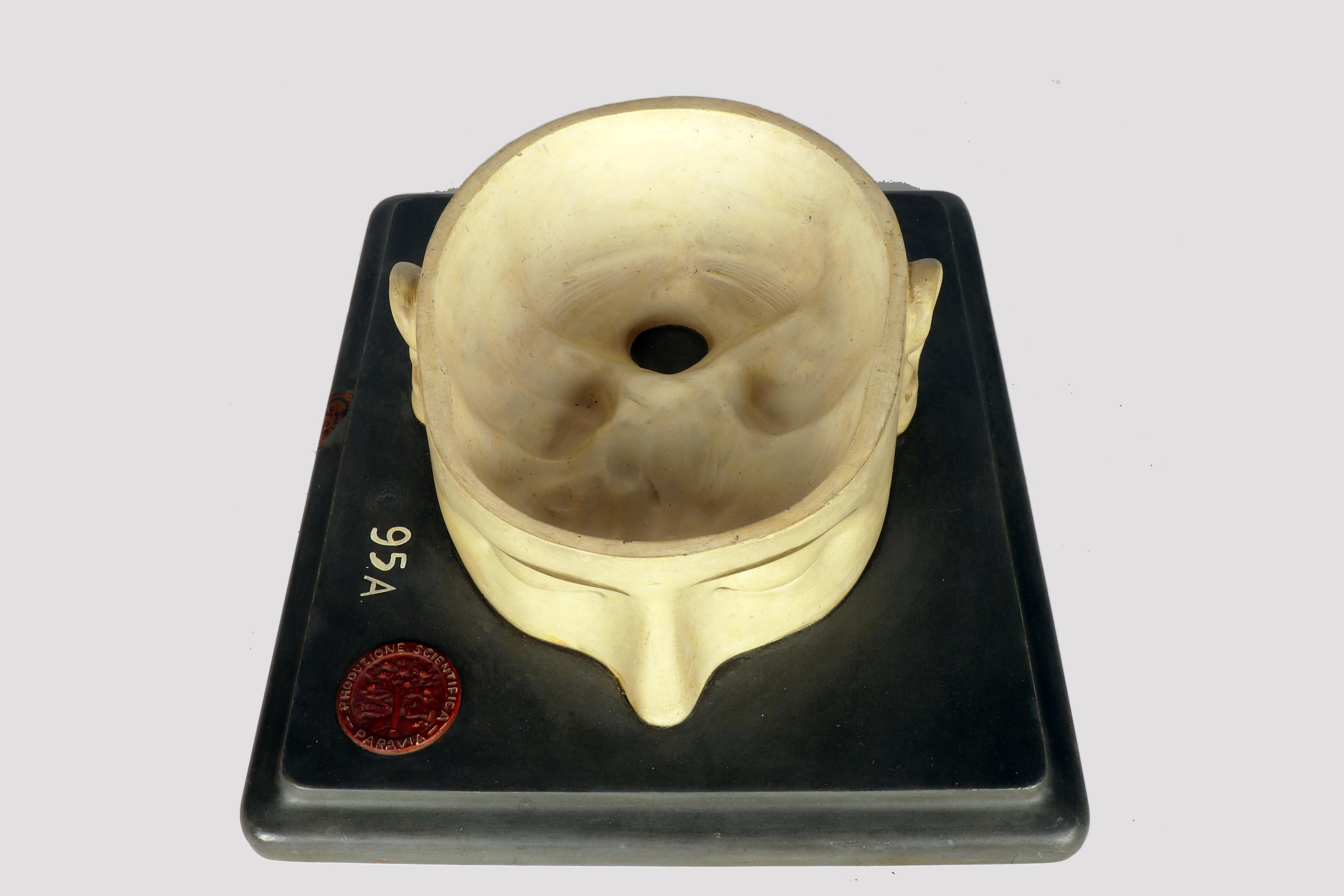 Modèle anatomique : un cerveau humain inséré dans une capuchon de crâne sectionnée, Italie 1920 en vente 3