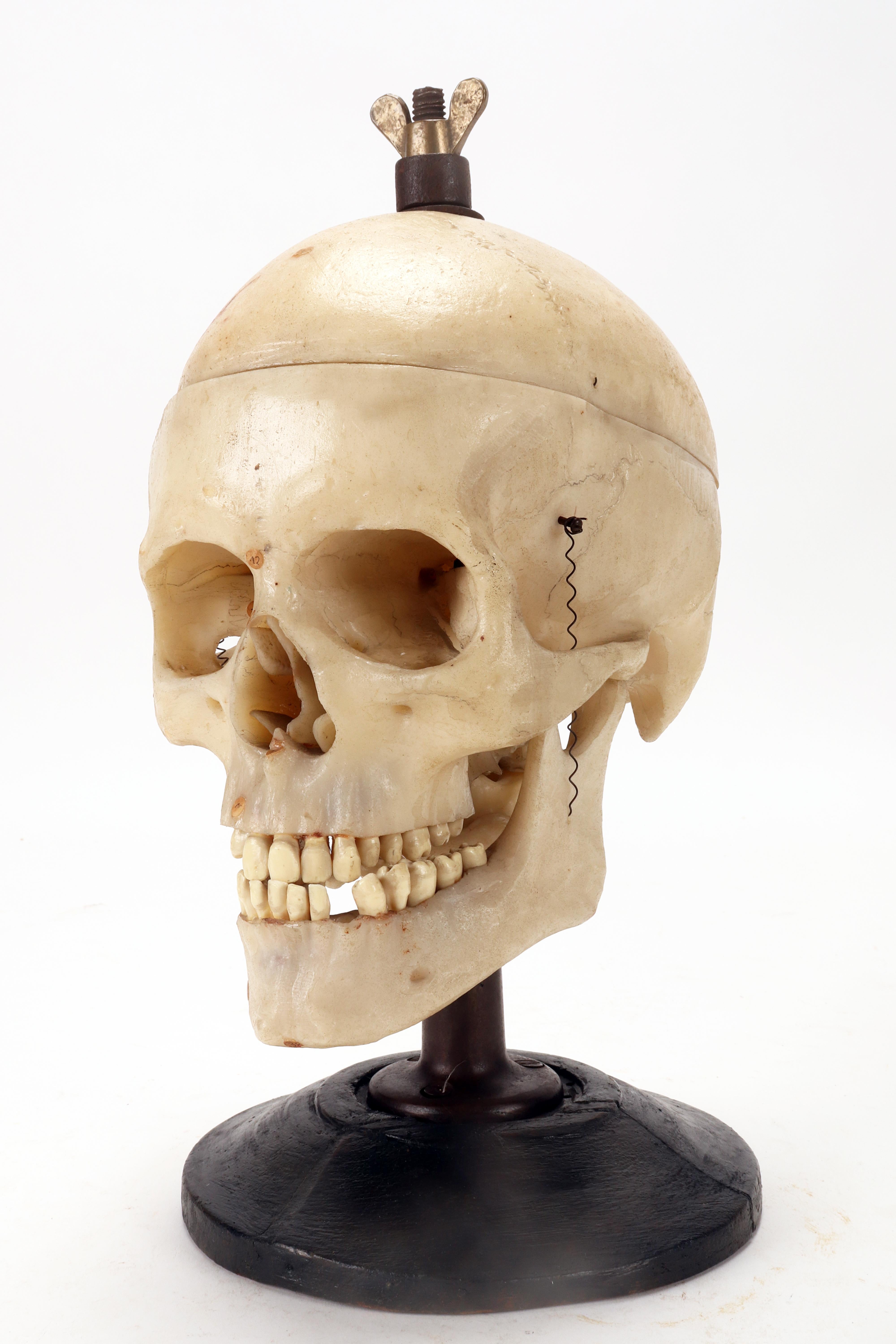 Iron Anatomical model: a human skull model life size, Stuttgard, Germany 1930. For Sale