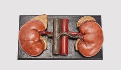Anatomical model for class, depicting the kidneys, Spain 1890.