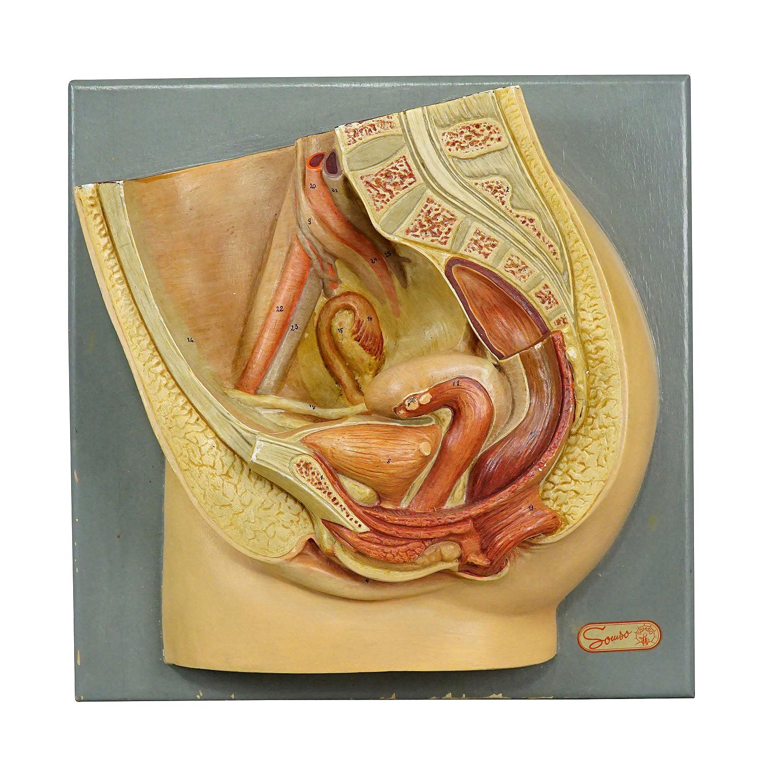 Anatomical Model, Median Incision of the Female Pelvic by Somso at 1stDibs