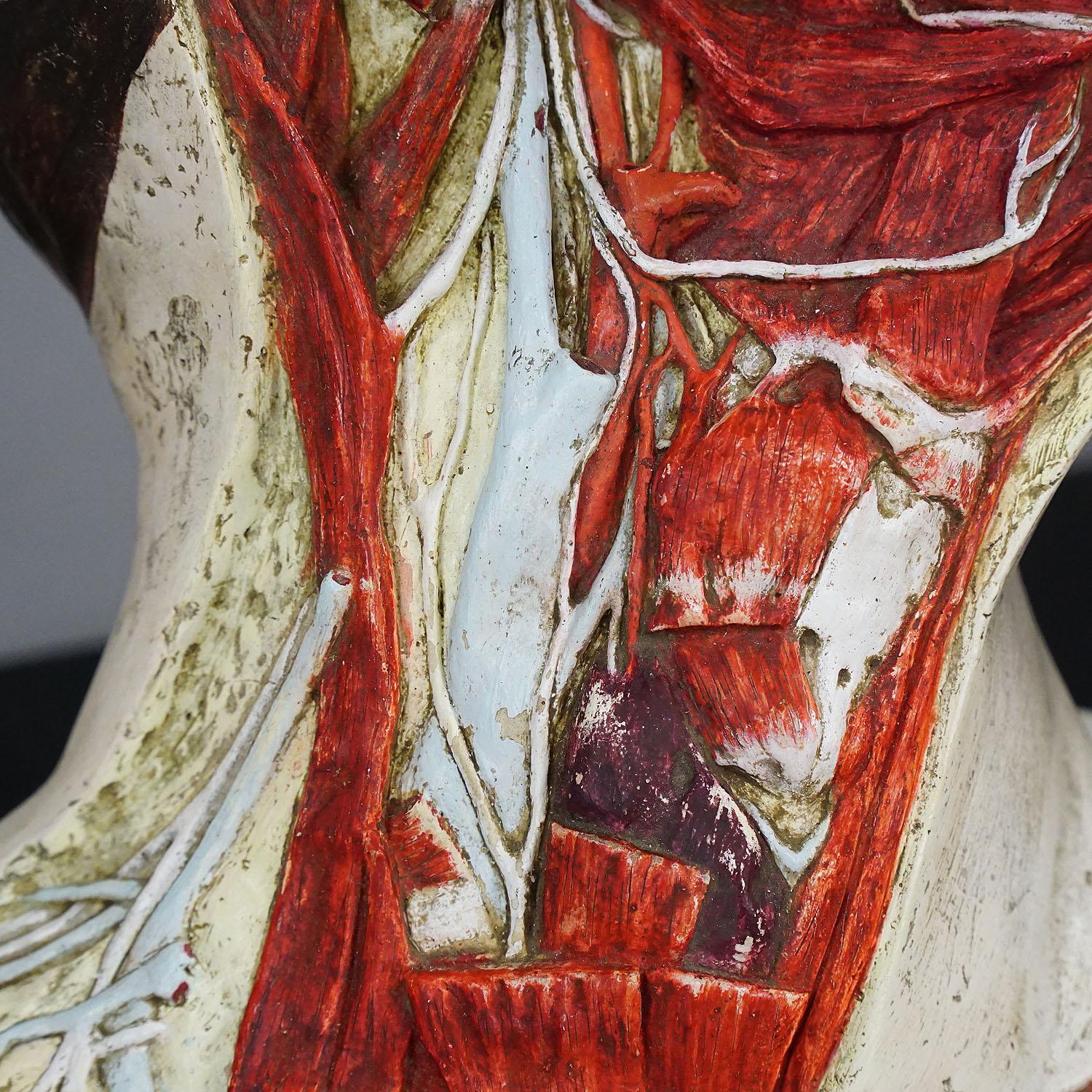 Anatomical Model of a Dissected Head by Nicolas-augier-roux, circa 1920 1