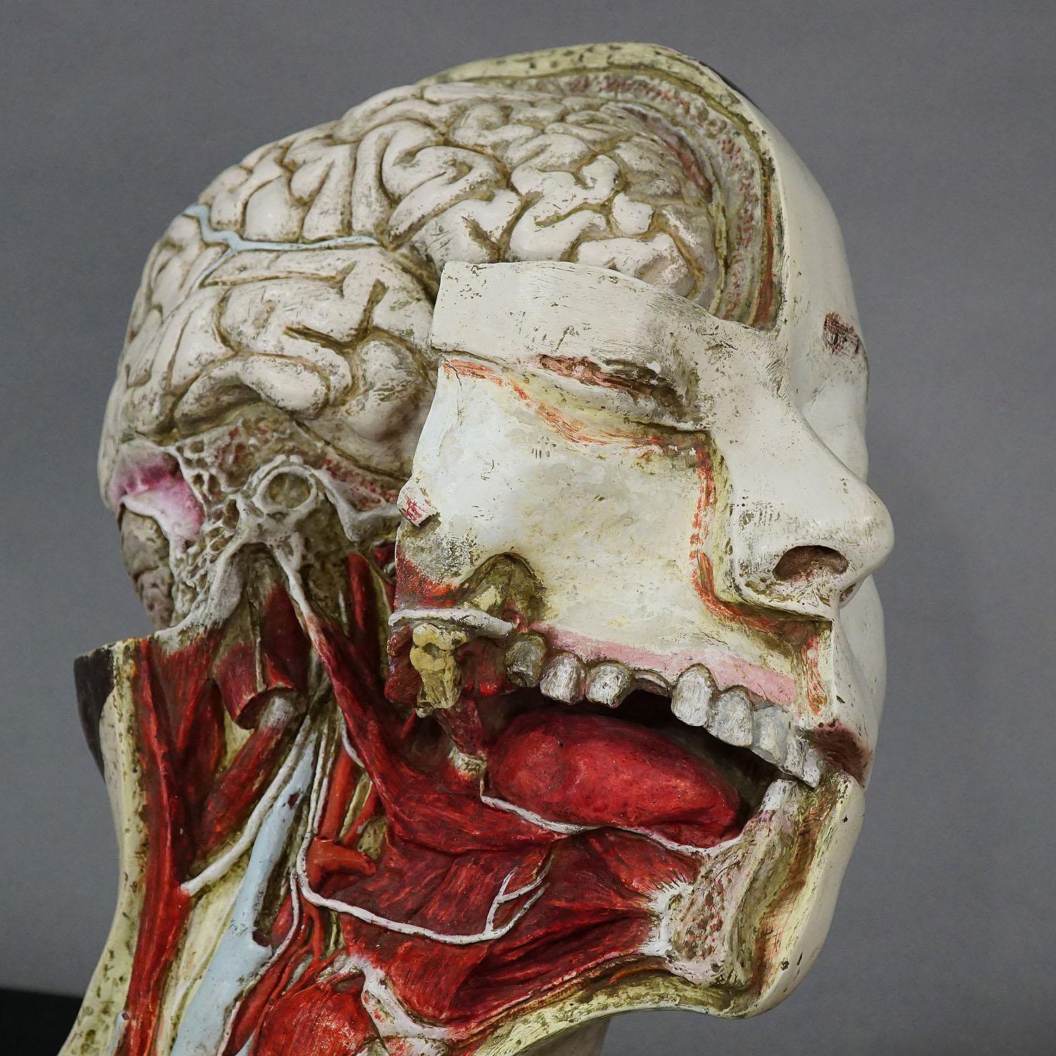 An exceptional anatomical model of a dissected head most probably from the Nicolas-Augier-Roux’s collection of anatomical plaster casts (1919-1939). The anatomical plaster casts of Nicolas-Augier-Roux where created by the Laboratory of Anatomy of