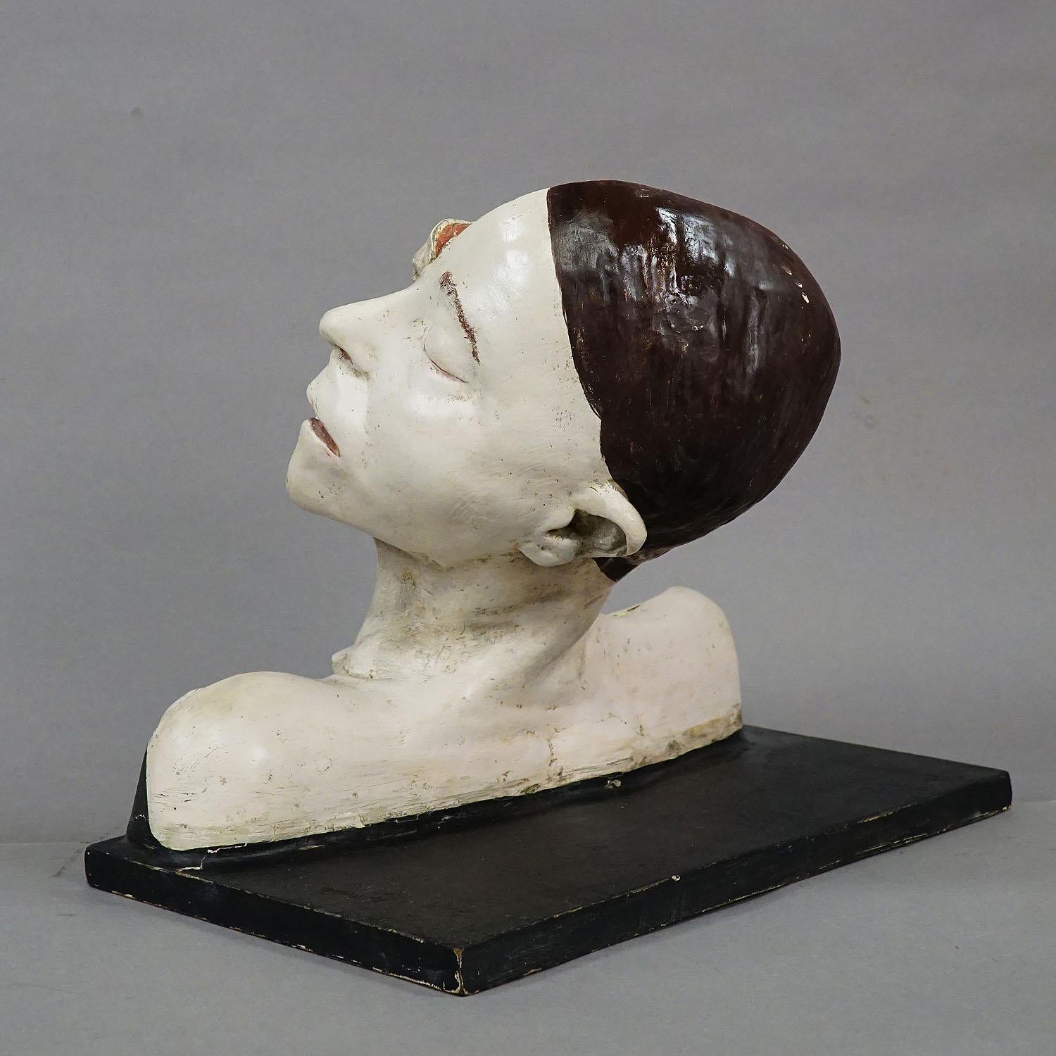 German Anatomical Model of a Dissected Head by Nicolas-augier-roux, circa 1920