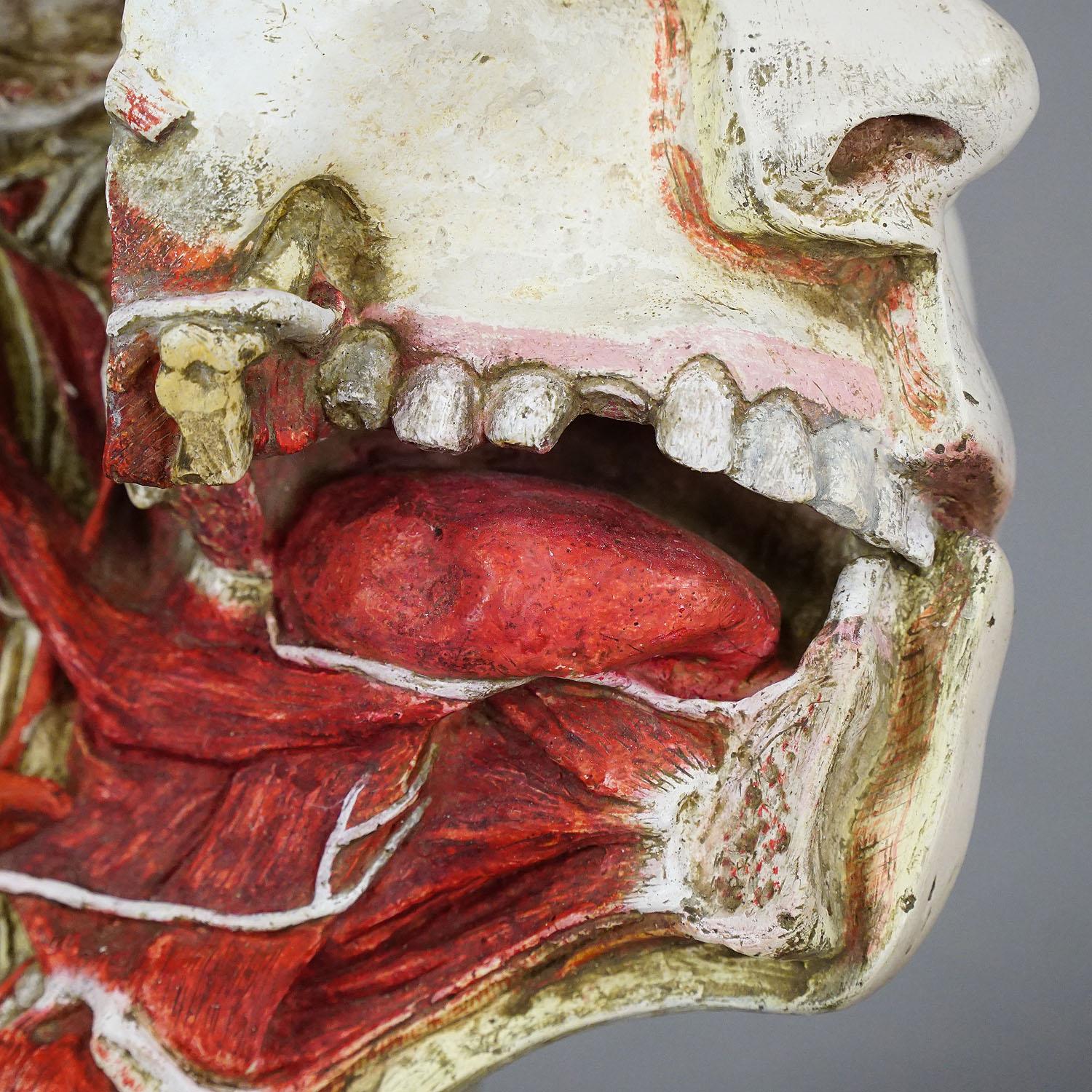 Plaster Anatomical Model of a Dissected Head by Nicolas-augier-roux, circa 1920