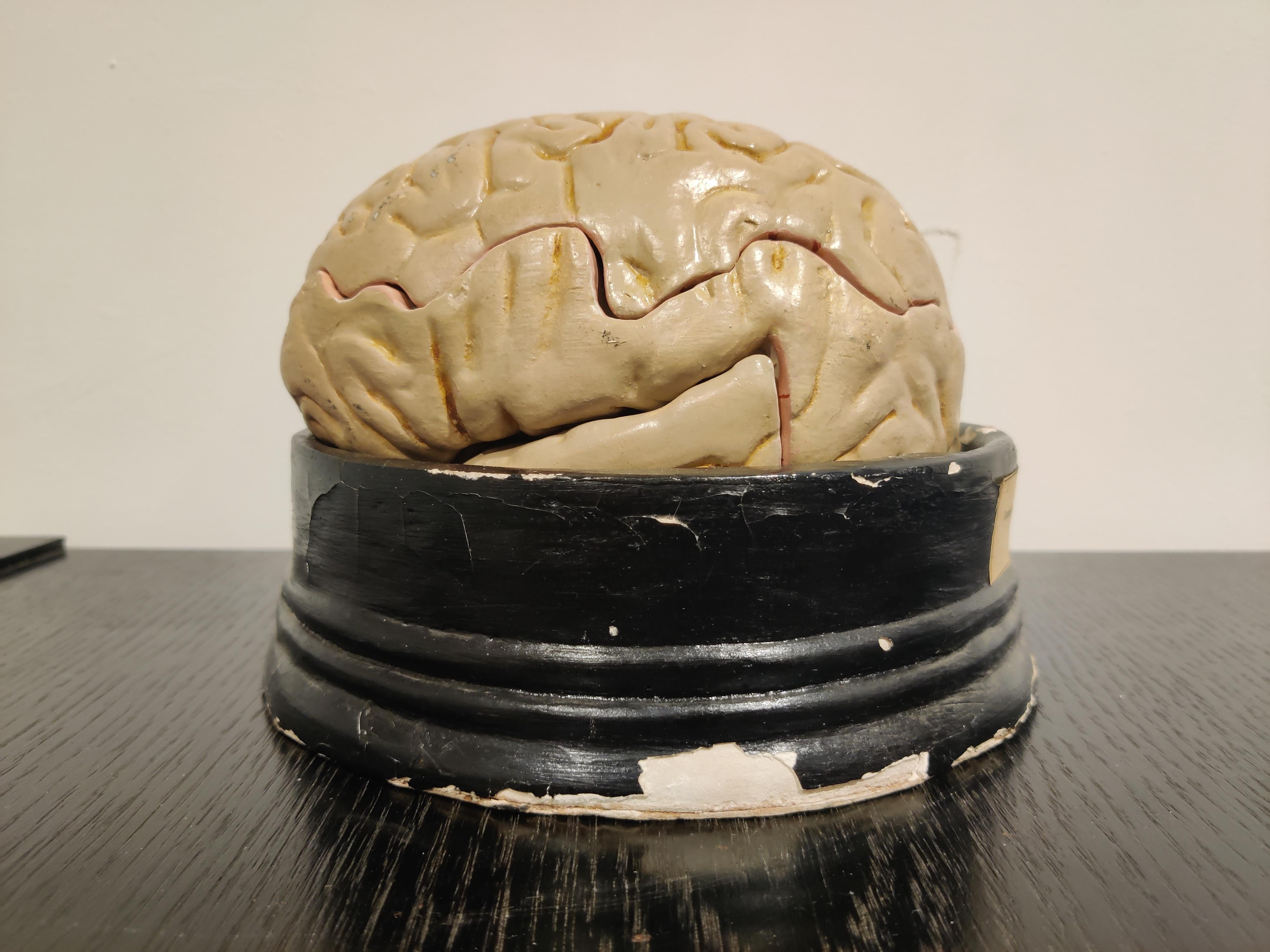 Latvian Anatomical Model of the Human Brain, 1950s