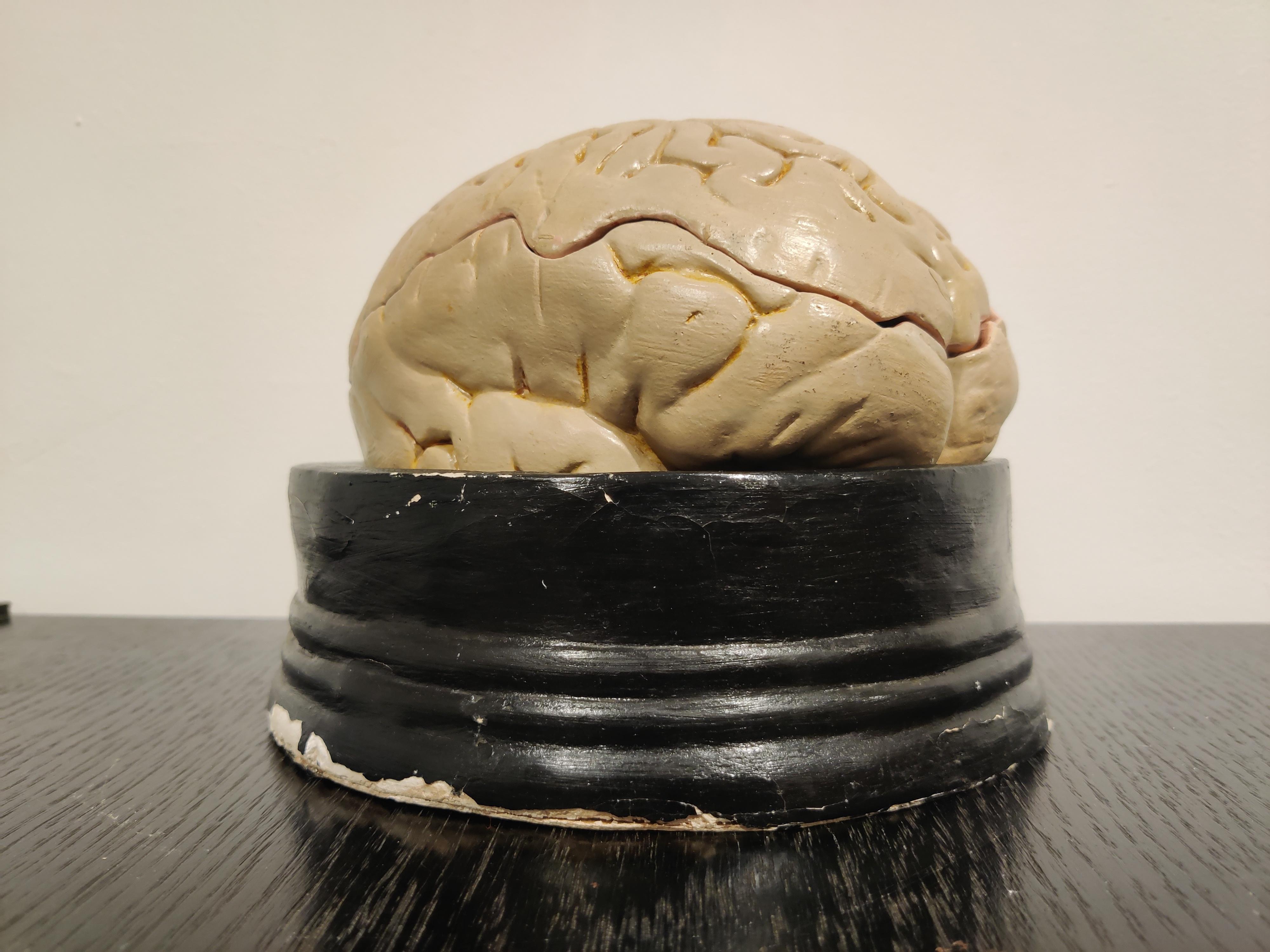 Mid-20th Century Anatomical Model of the Human Brain, 1950s