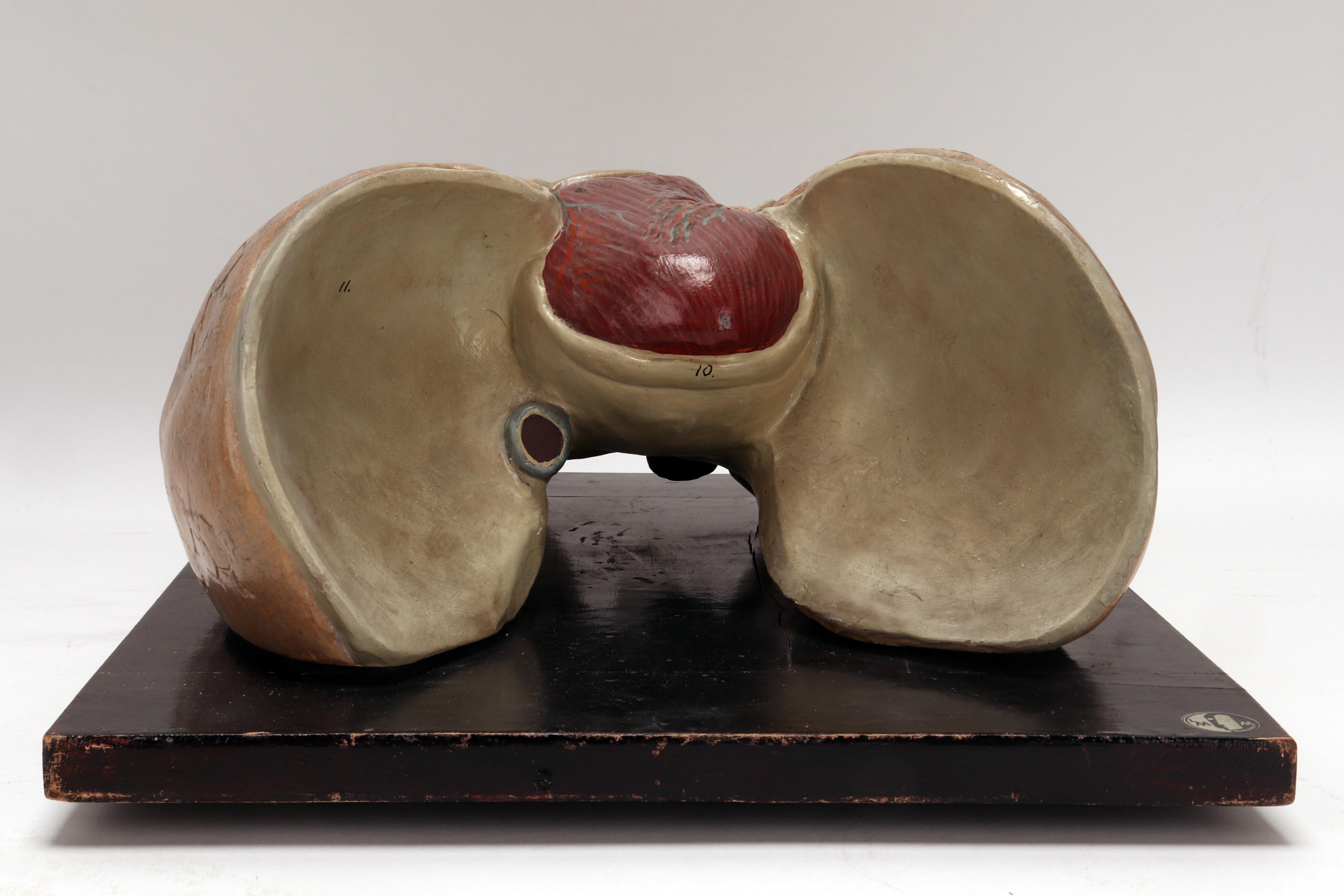 Anatomical Model of the Lungs and Heart, Germany 1920 In Good Condition For Sale In Milan, IT