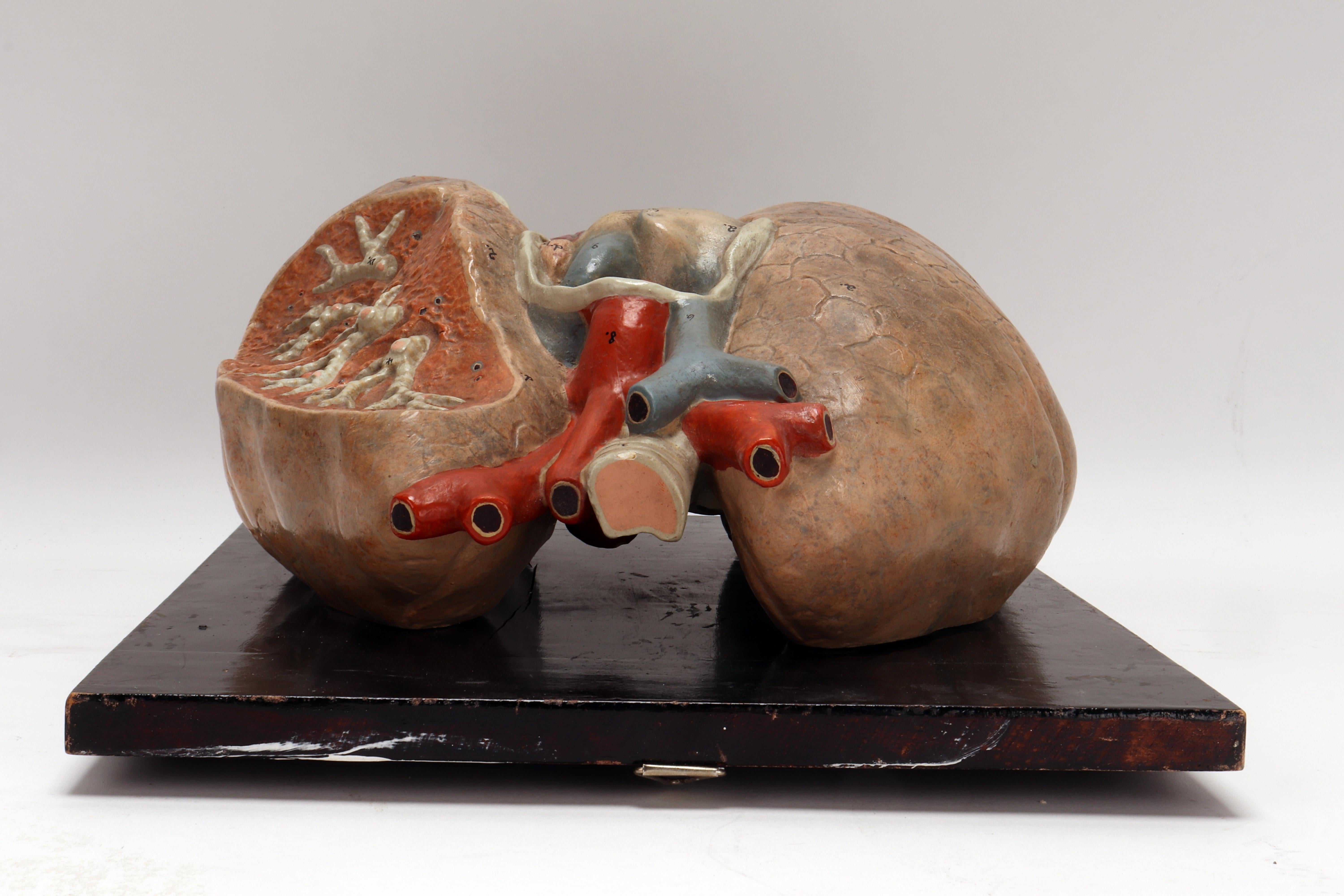 Plaster Anatomical Model of the Lungs and Heart, Germany 1920 For Sale