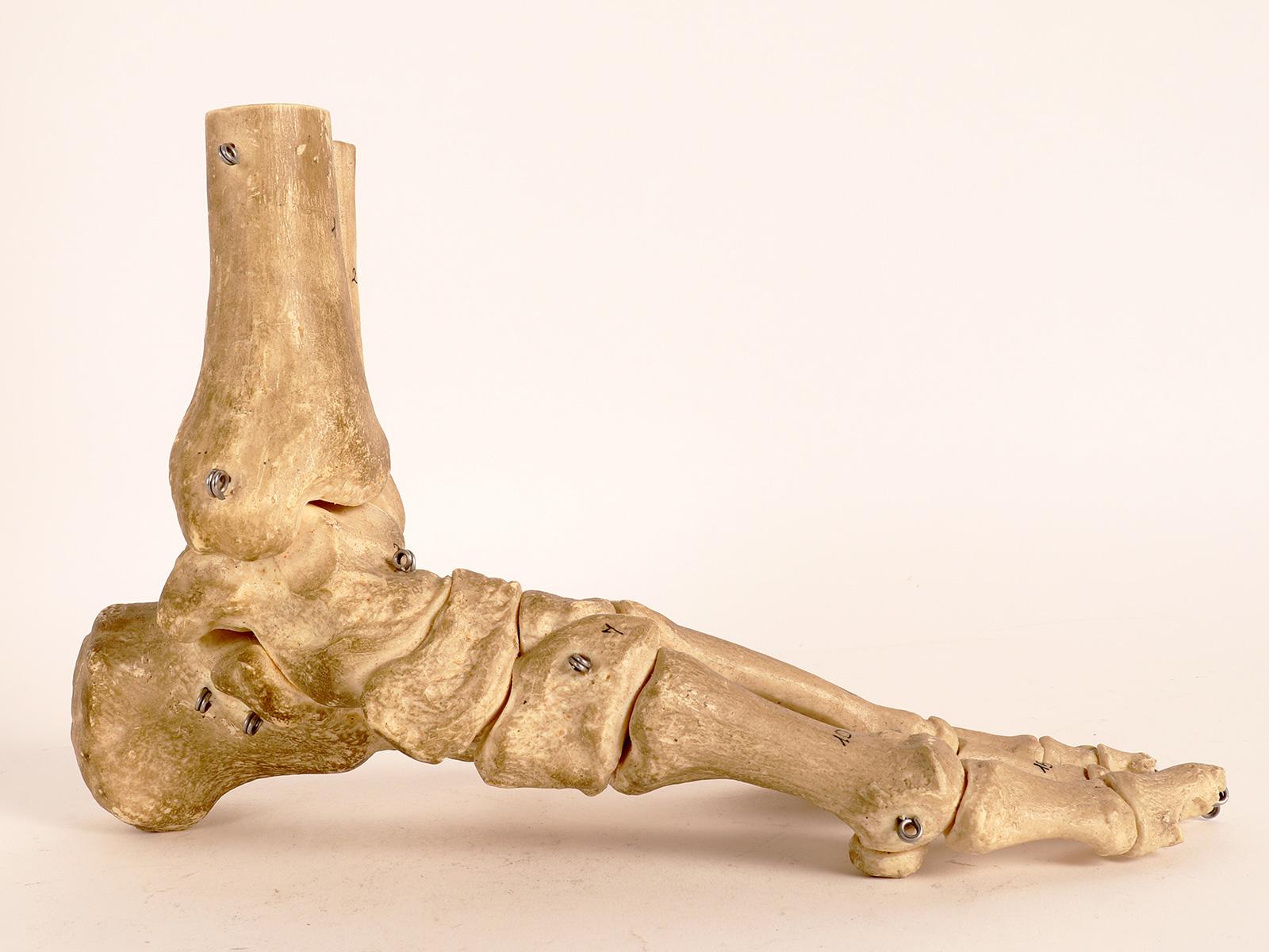 Anatomical model depicting the skeletal part of a foot, made by Somso, Sonenberg. Germany, circa 1970.