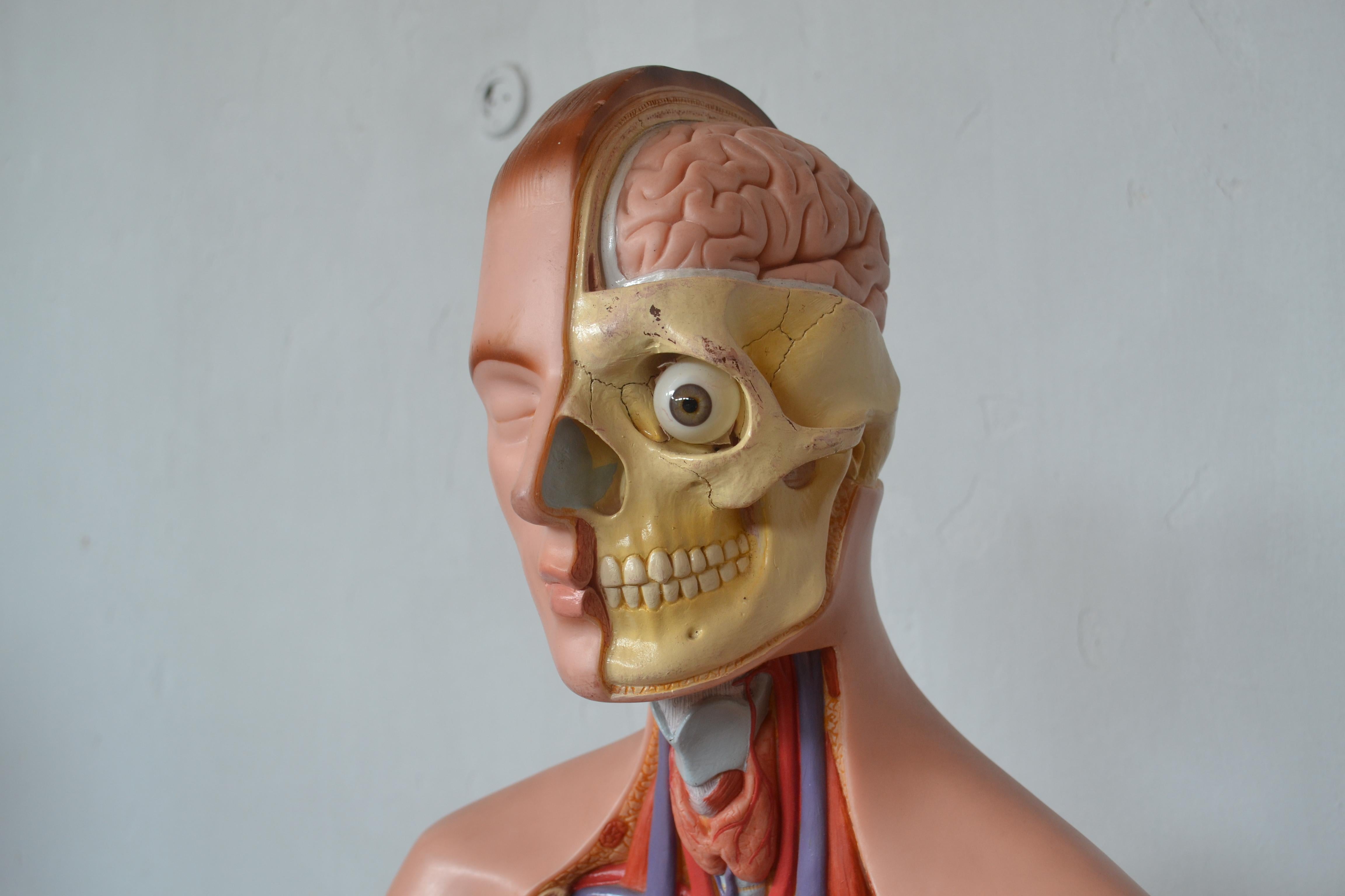 Cast Anatomical Sculpture by Marcus Sommer for Somso, 1960s For Sale
