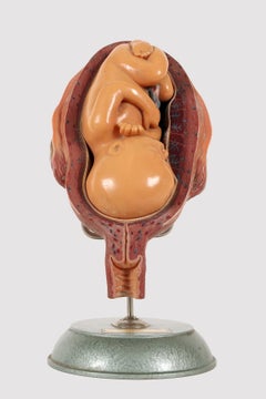 Anatomisches Lehrmodell, der elterliche Fötus. Somso, Deutschland, 1950er Jahre.