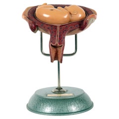 Anatomical teaching model, the prenatal fetus. Somso, Germany, 1950s.