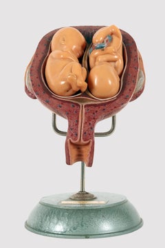 Anatomisches Lehrmodell, der pränatale Zwillingsfötus im Mutterleib. Somso Deutschland 1950
