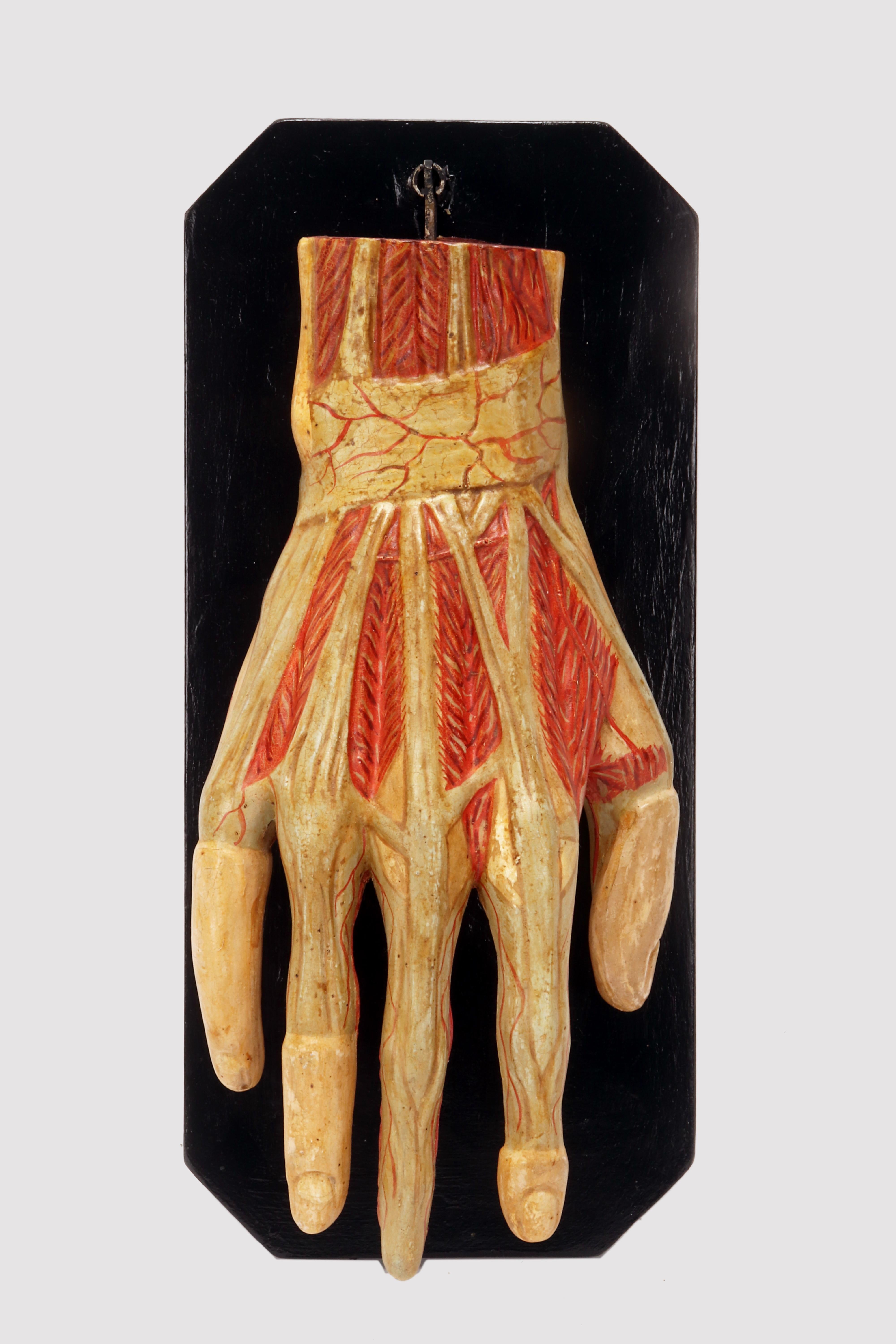 Anatomical model for schools, educational use, depicting the hand swinging on a fork supported by a black lacquered wooden base.
Made of plaster and finished entirely in colour. Italy circa 1900.
