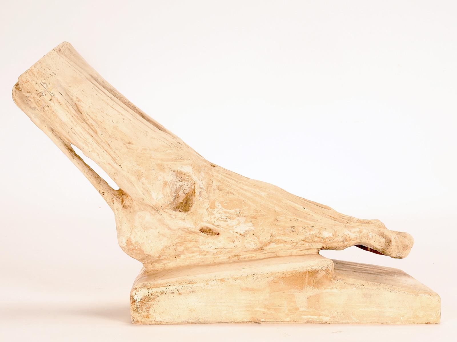 Italiano Antico modello anatomico in gesso di un piede scorticato, Italia 1900. in vendita