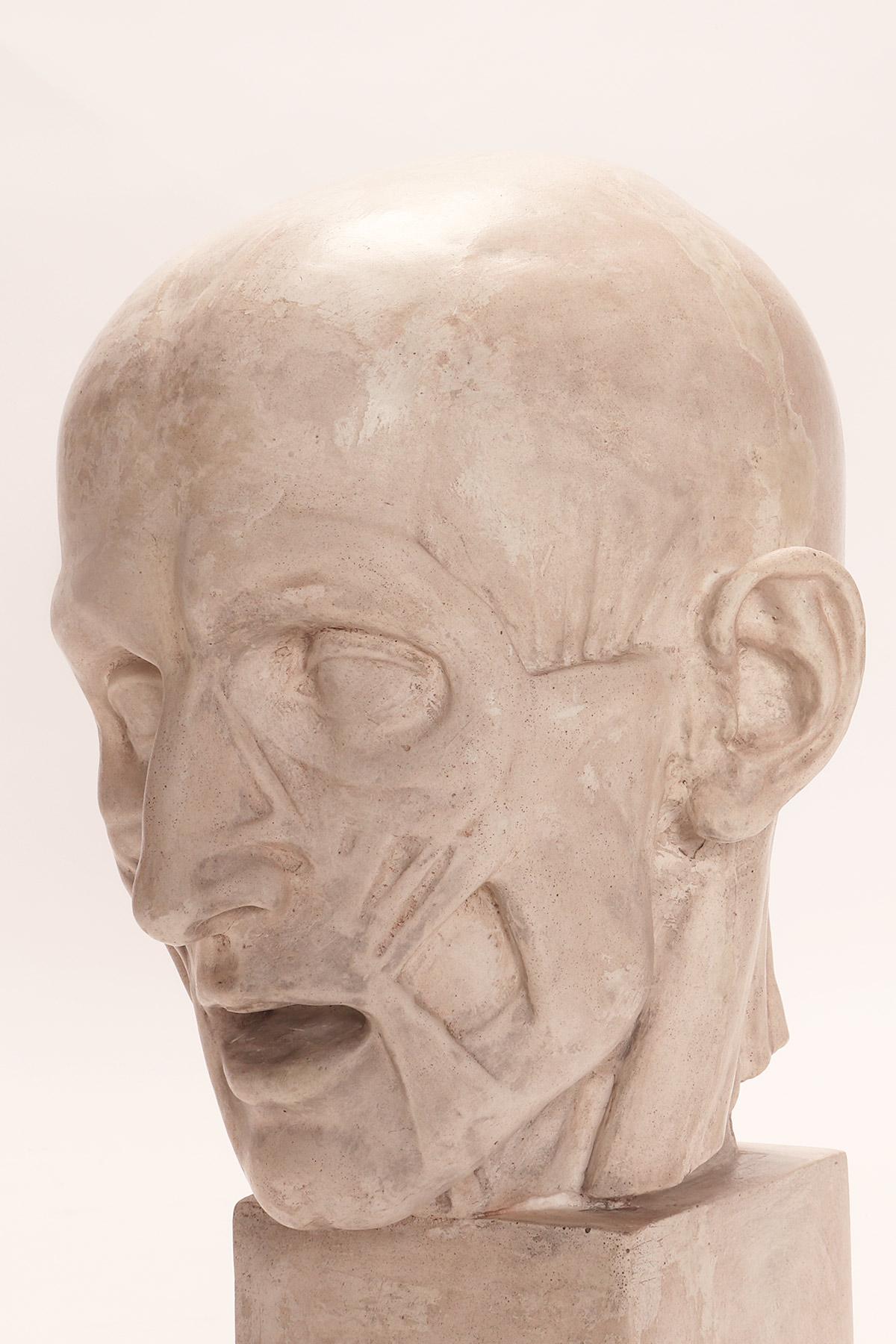 Modelo anatómico antiguo de escayola de una cabeza parcialmente desollada, Italia 1900. en venta 4