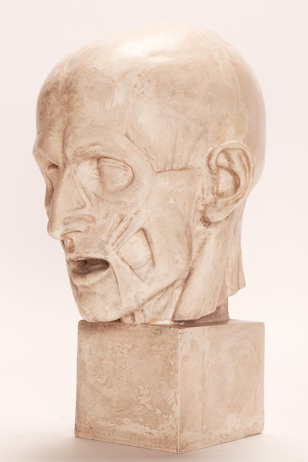 Modelo anatómico antiguo de escayola de una cabeza parcialmente desollada, Italia 1900. en venta 1