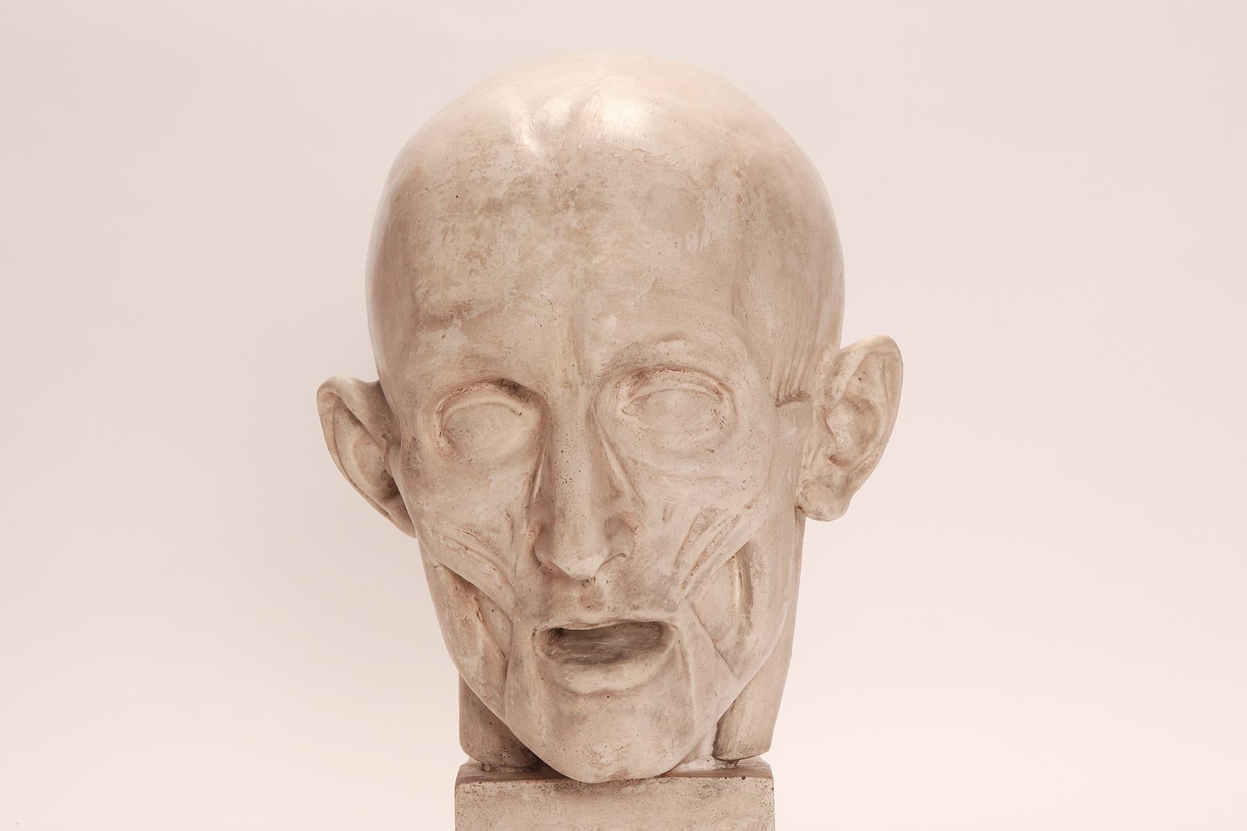 Modelo anatómico antiguo de escayola de una cabeza parcialmente desollada, Italia 1900. en venta 2