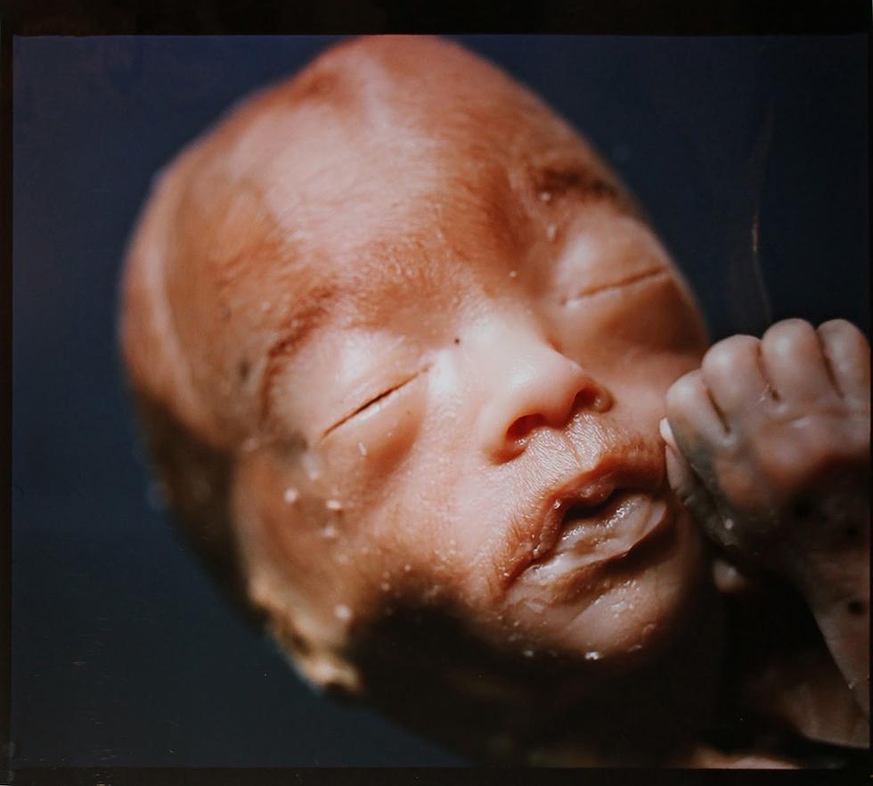 Andres Serrano Figurative Print - The Unborn