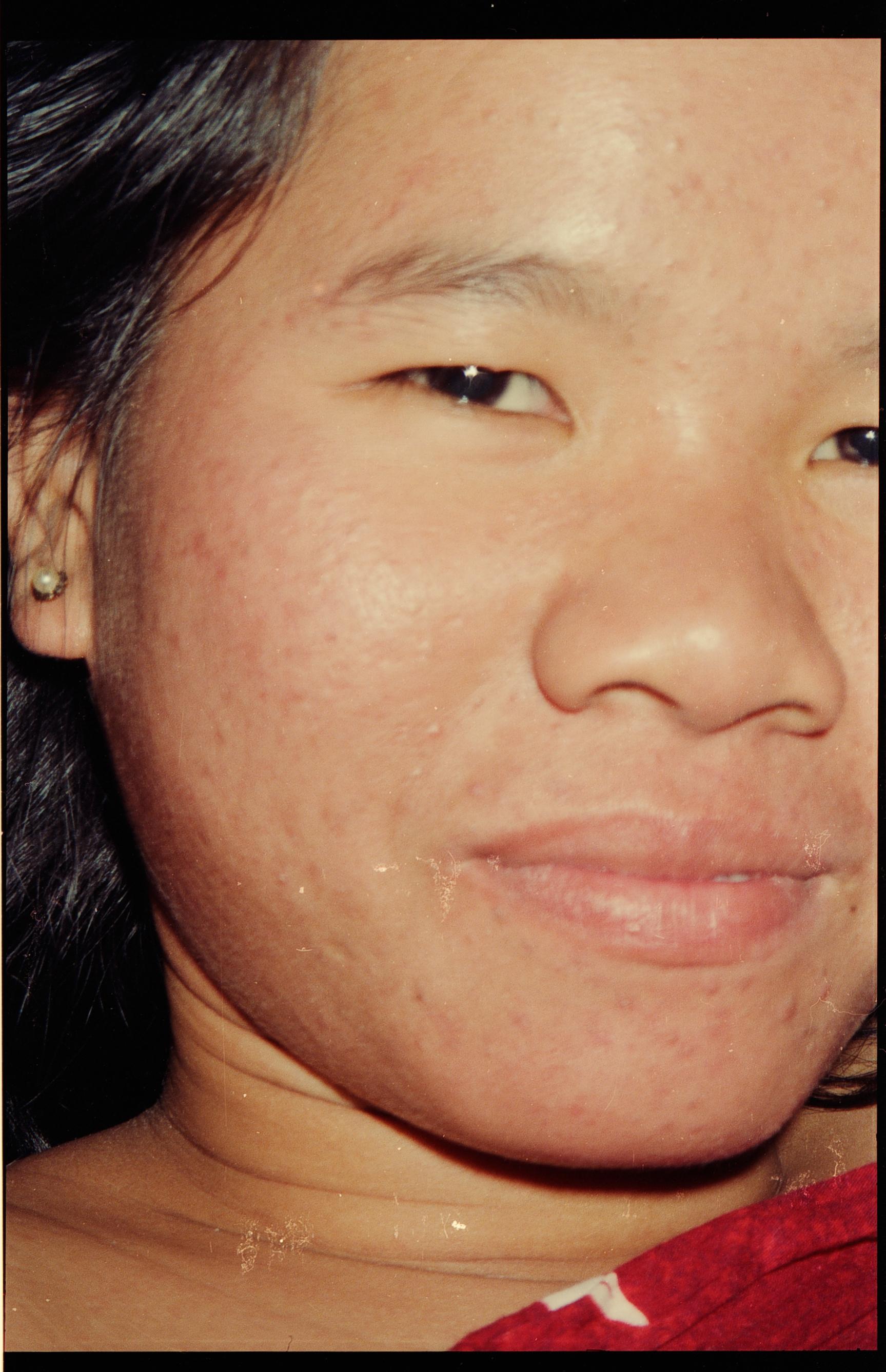 Puuh, Thailand, 1987