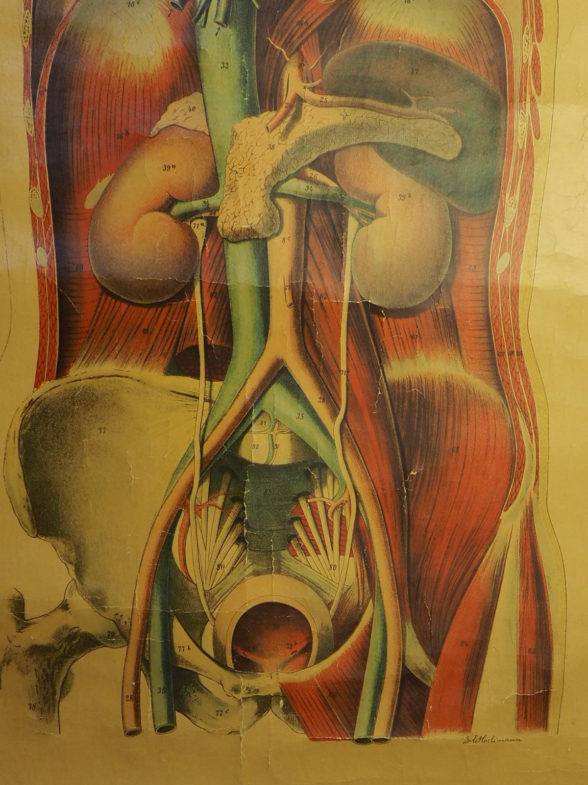 Lin Tableau anatomique ancien (V.) Anatomie humaine signé par E. Hoelemann en vente