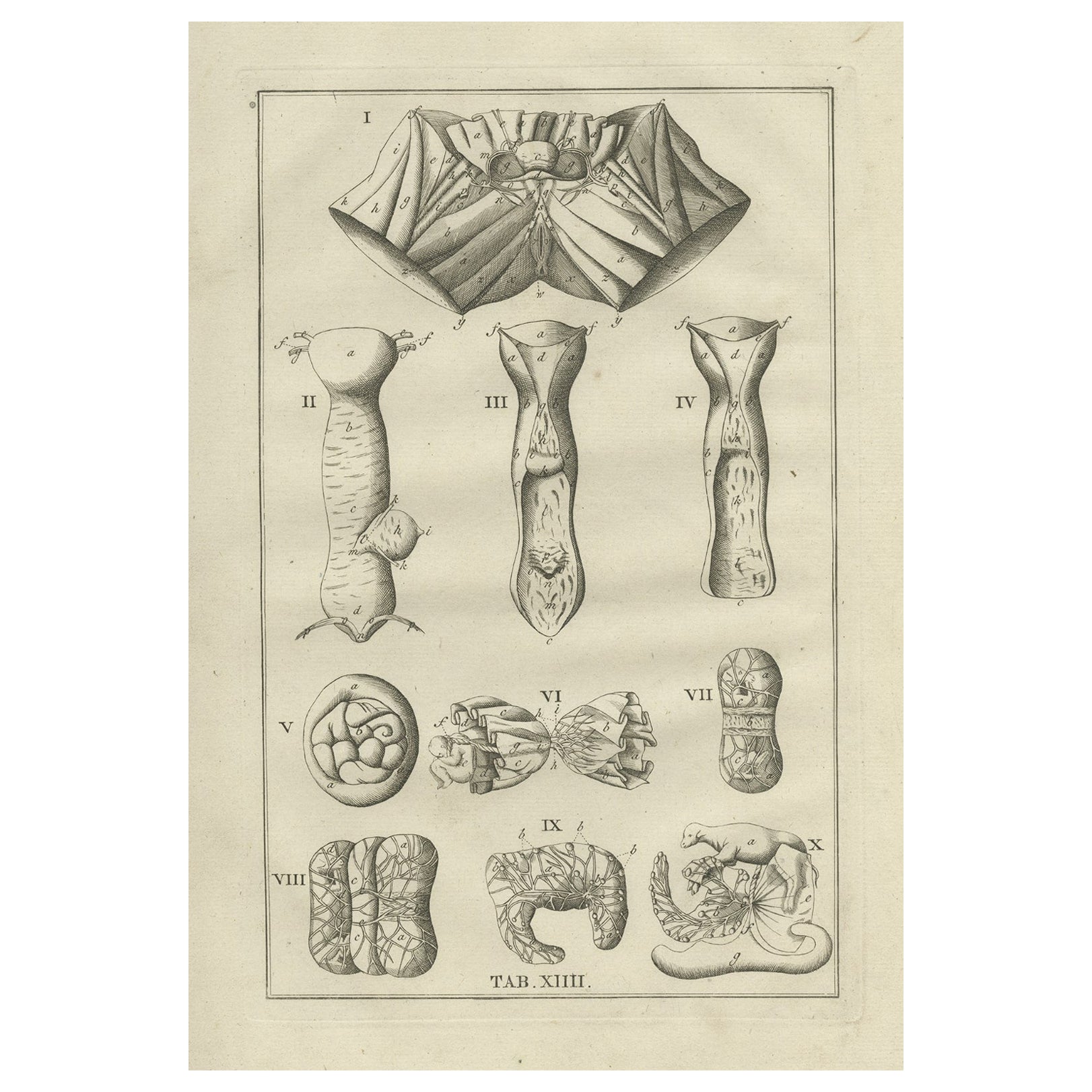 Antique Anatomy Print of the Female Reproductive Organs, 1798