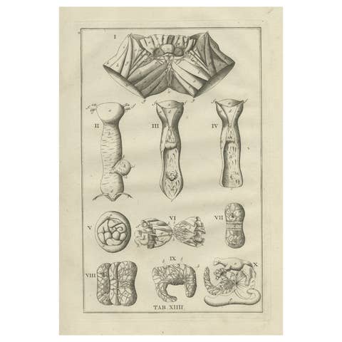 Antique Anatomy Print of the Female Reproductive Organs, 1798